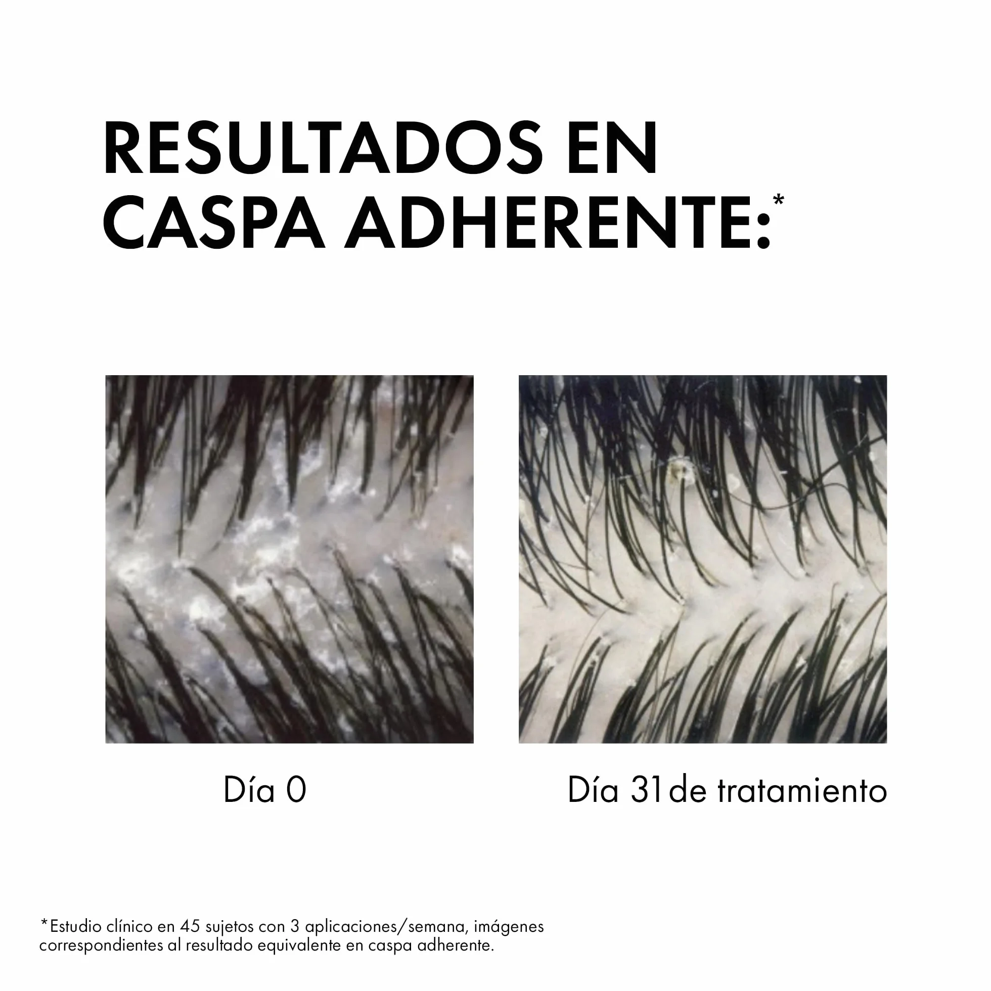 Vichy Dercos Technique Champú Anticaspa 400 ml Cabellos Seco