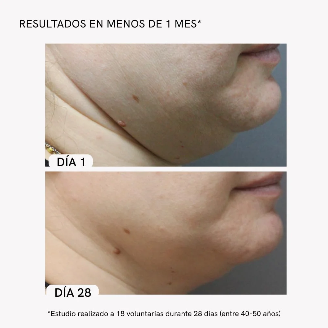 MASDERM Masajeador Facial y Cuello Profesional Radiofrecuencia 500 ml, Luz Roja RF, Lifting Facial 2 Pack