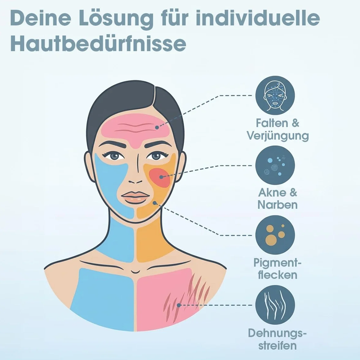 P-Beauty Dermapen M1 Cartuchos de aguja para microneedling – Repuesto para Derma Elektrik Pen M1 – Cierre de rosca