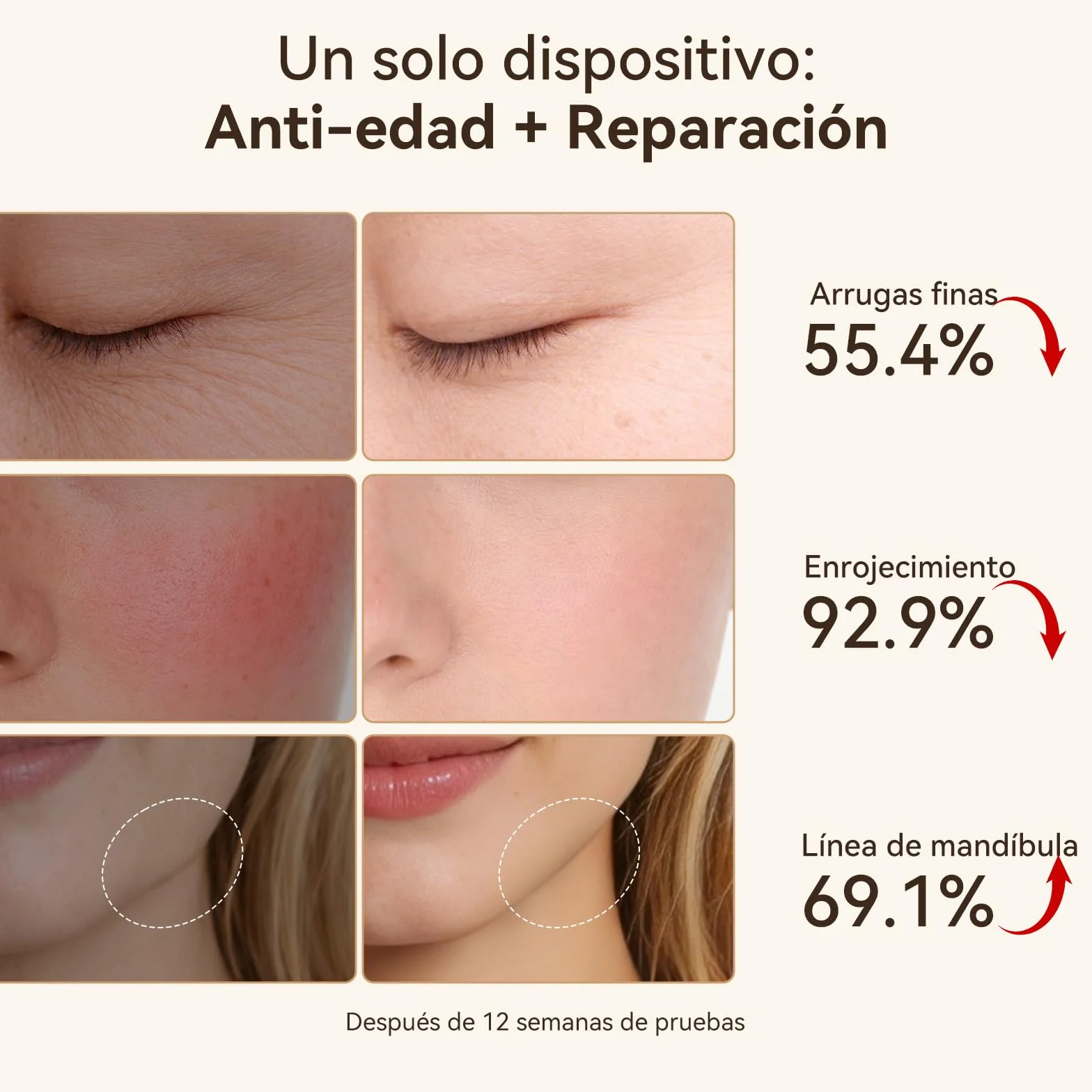 ANLAN Mini Radiofrecuencia Facial 24 Oro RF 3 Modos 3 LED 42-50°C EMS Masajeador Antiarrugas IPX6