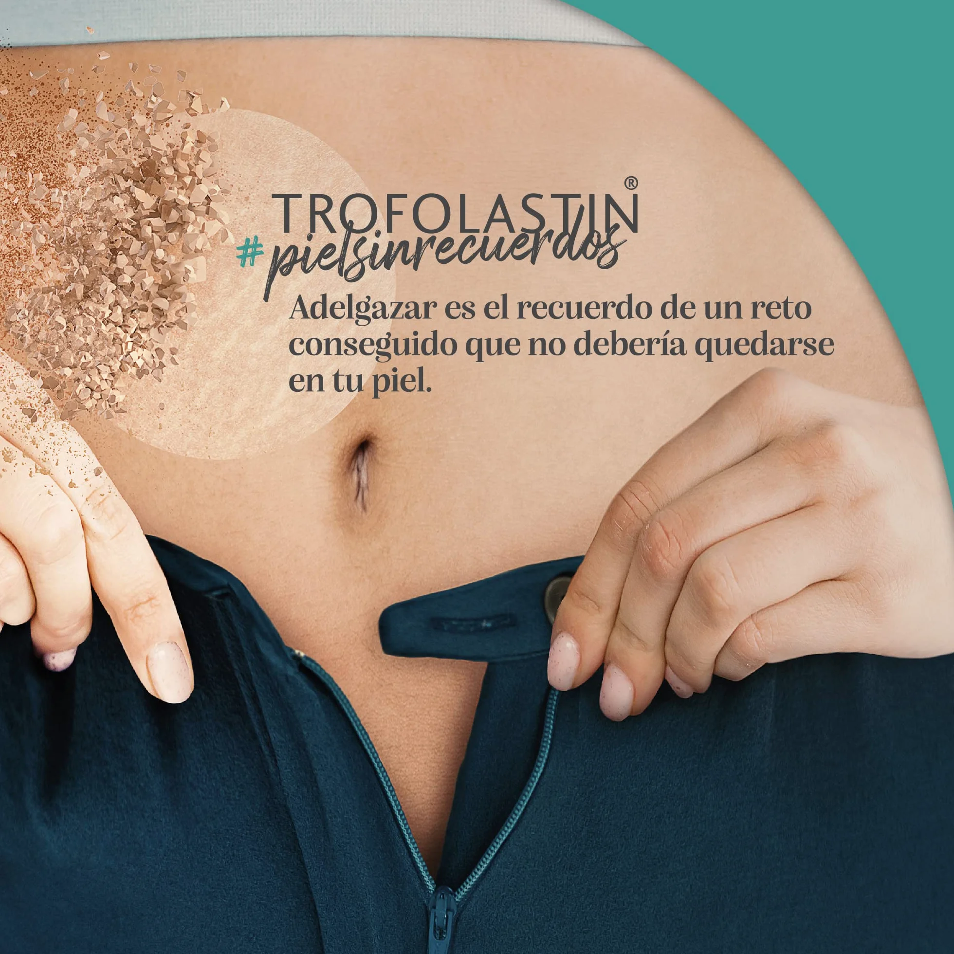 Trofolastin Crema Antiestrías Reafirmante 250ml con Centella Asiática