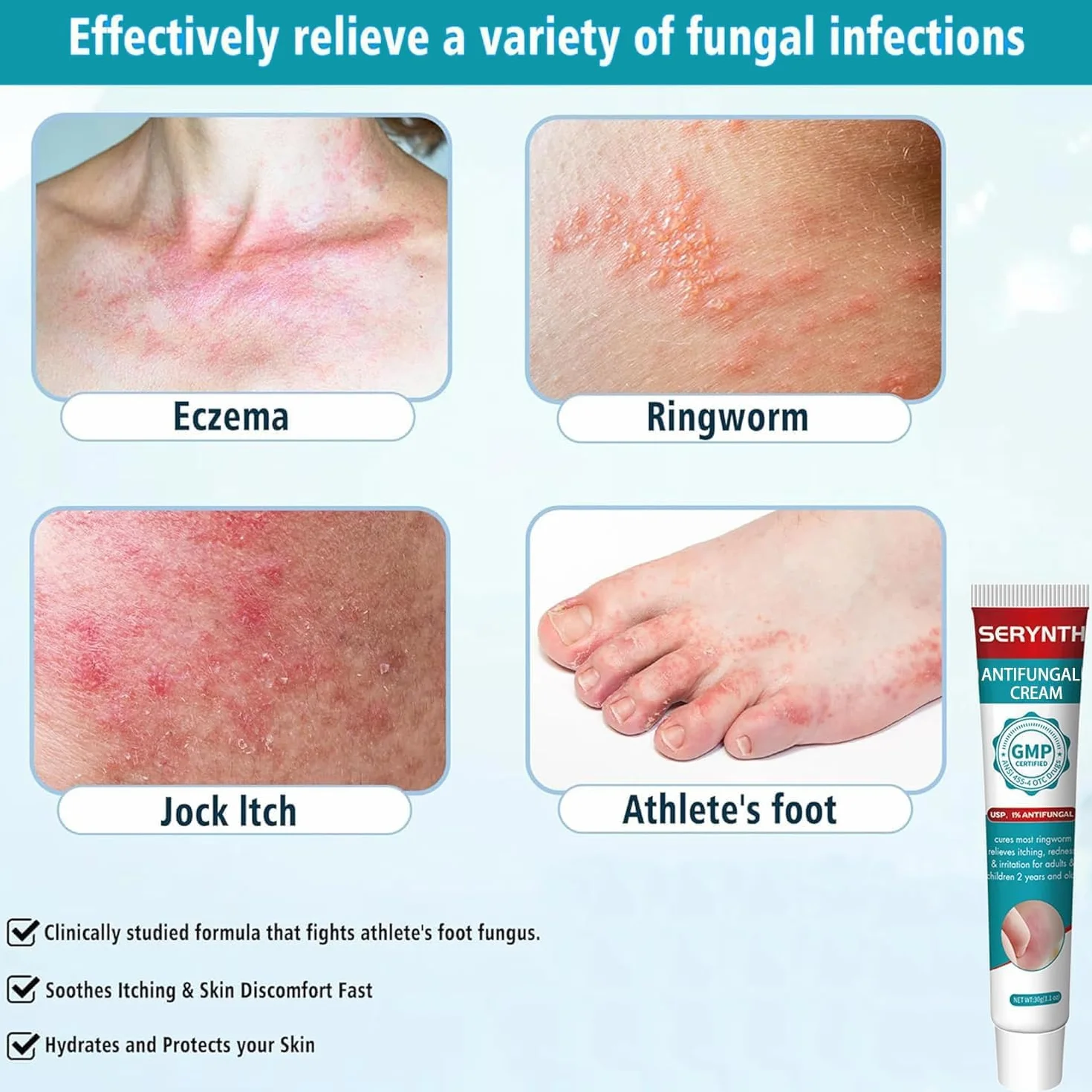 Crema Antifúngica 30g para Aliviar Picazón, Eczema, Pie de Atleta - Tratamiento Eficaz