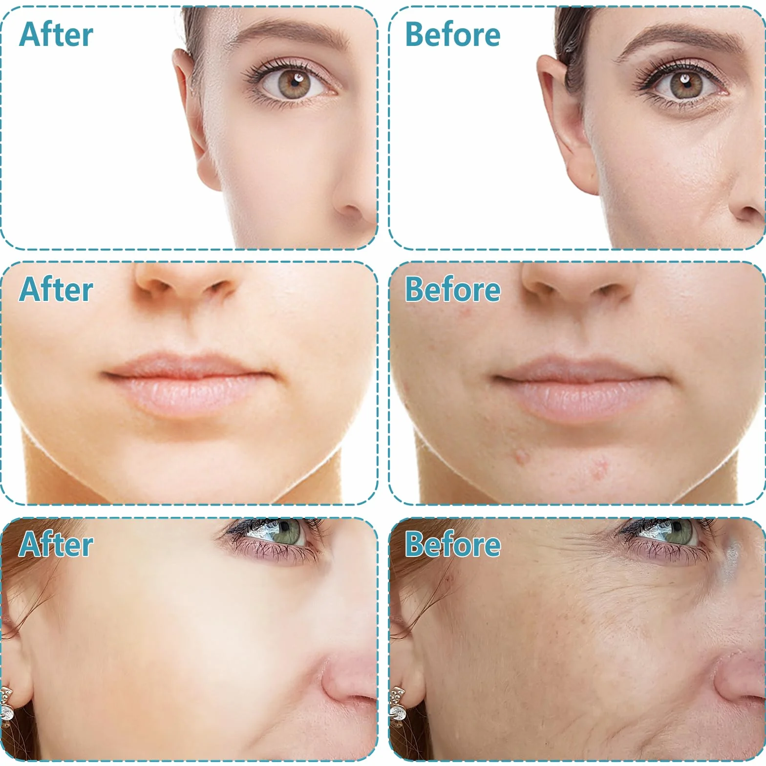 GeeRic 2 Un Rodillo Facial Ice Globes Masaje de Hielo Bola Belleza Facial Masajeadores Piel Fría Hinchazón Ojeras Rosa