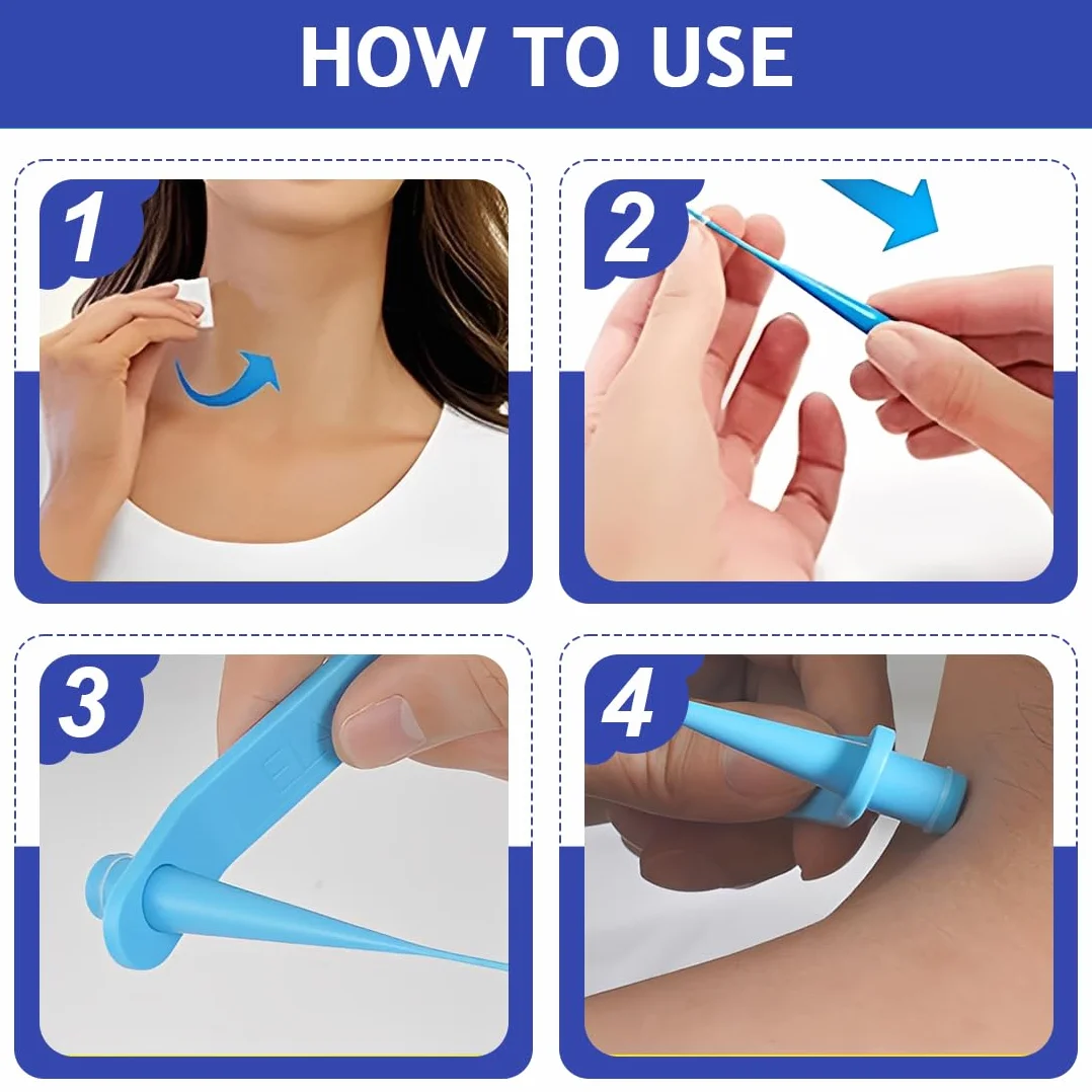Skin Tag Remover Set para Eliminar Verrugas y Lunares Eficaz e Indoloro