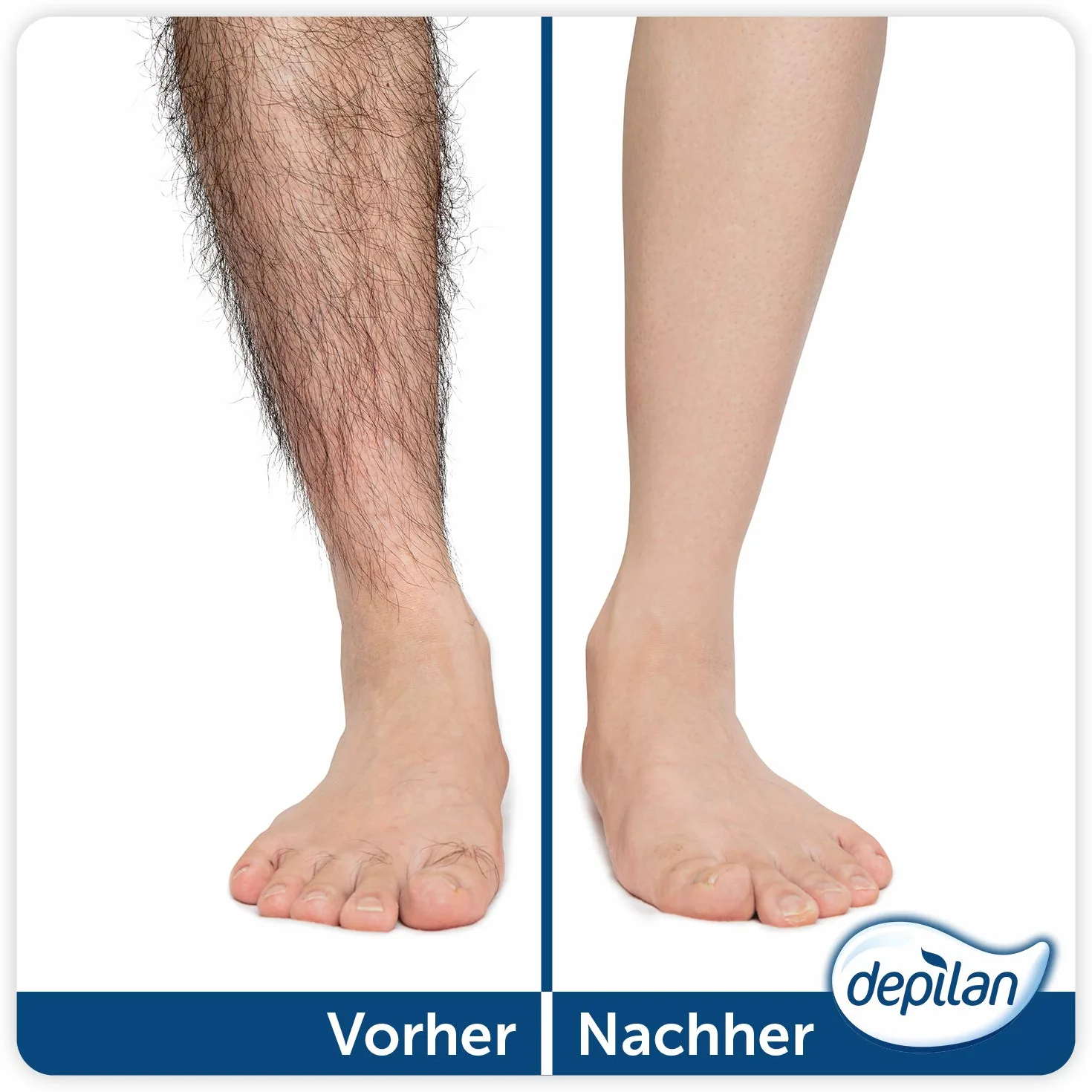 Depilan Body Depilatoria Spray 200 ml para Hombres