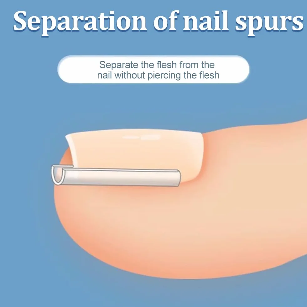 Juego de Corrector de Uñas Encarnadas 50 PCS Tiras Enderezadoras sin Dolor con Elevador de Uñas del Pie