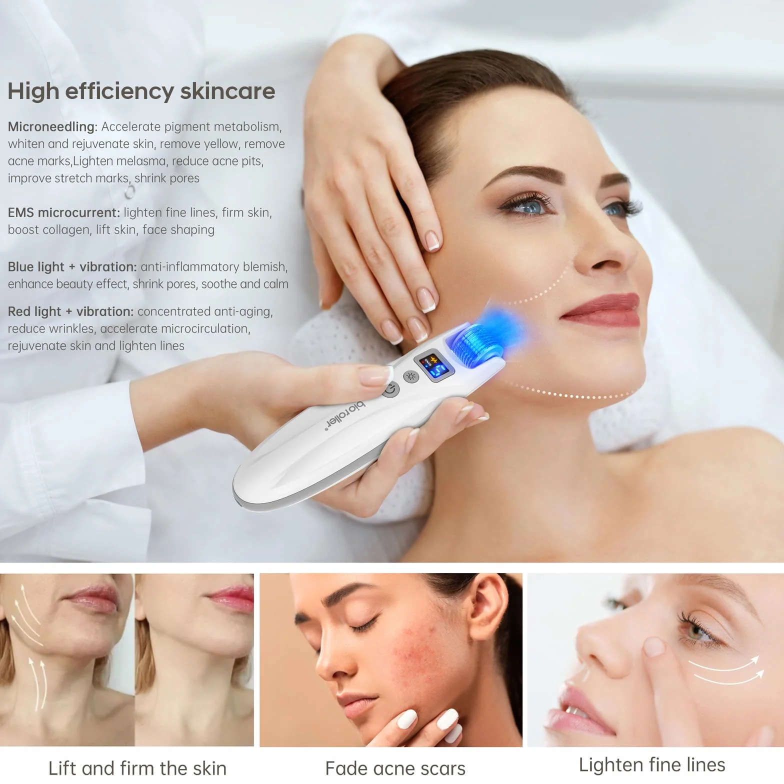 G5 Microneedling Roller Pen Eléctrico Kit 5 Niveles EMS LED Roja Azul Rostro Cuerpo Cabello Barba 2 Cartuchos