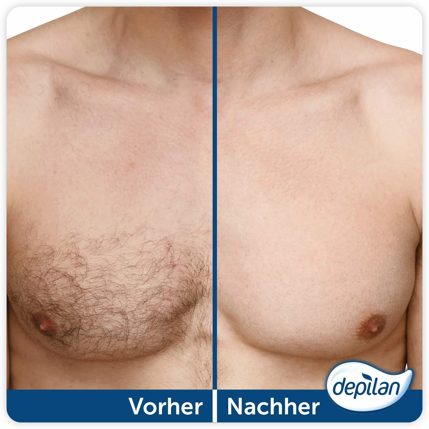 Depilan Body Depilatoria Spray 200 ml para Hombres