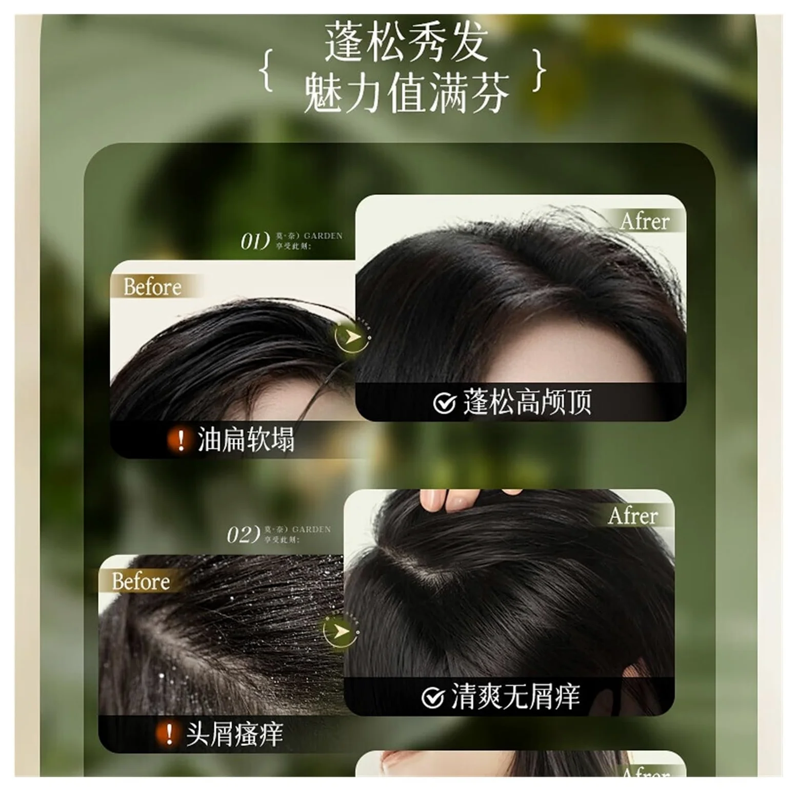 Champú anticaspa y control de grasa | Control eficaz de la caspa y gestión de la grasa, lo que da como resultado una piel naturalmente voluminosa.(3pcs)