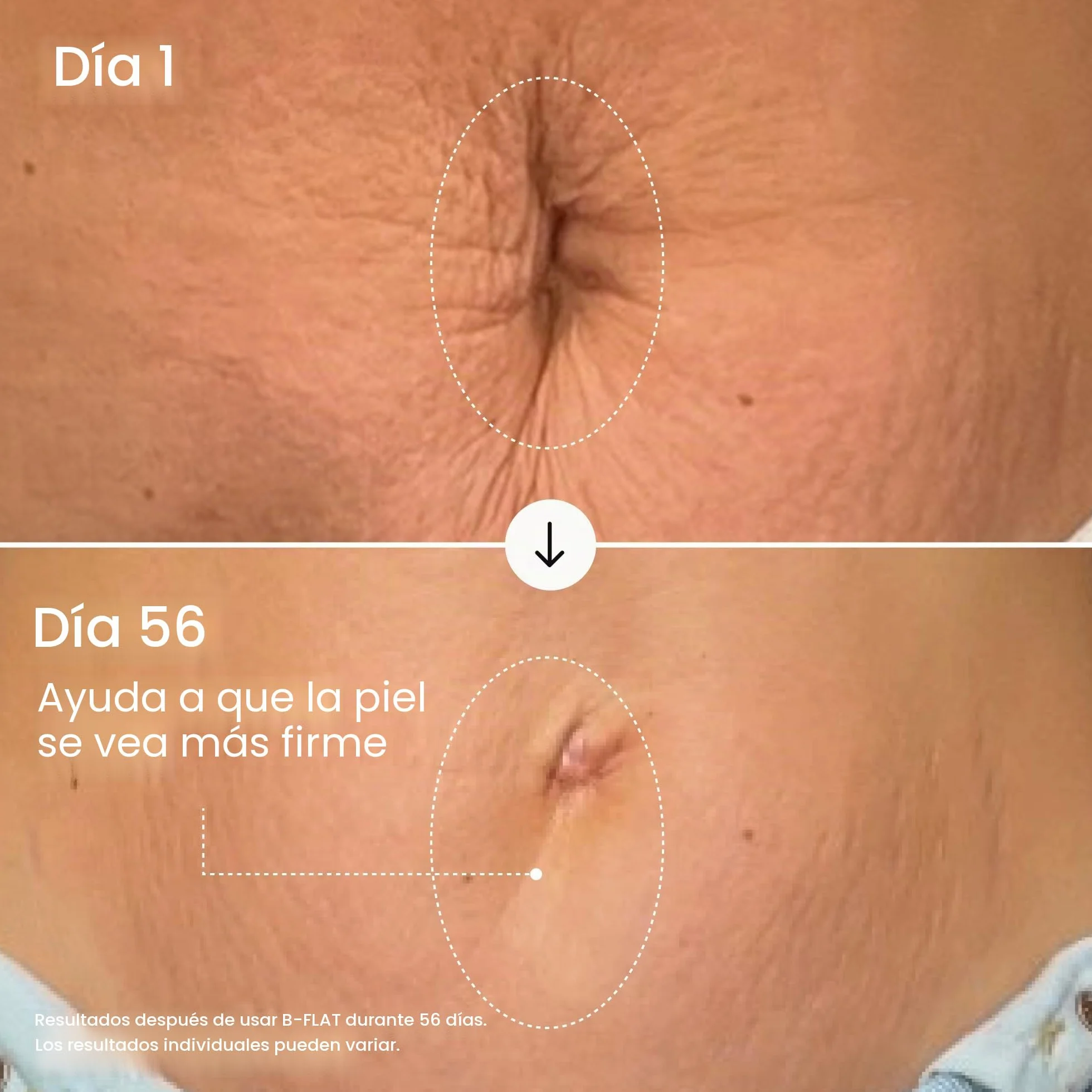 B-Flat Cellulite Stretch Marks Firming Cream | Belly Skin Treatment | Anti-Cellulite Stomach Lotion with Arabica Coffee & Hyaluronic Acid.