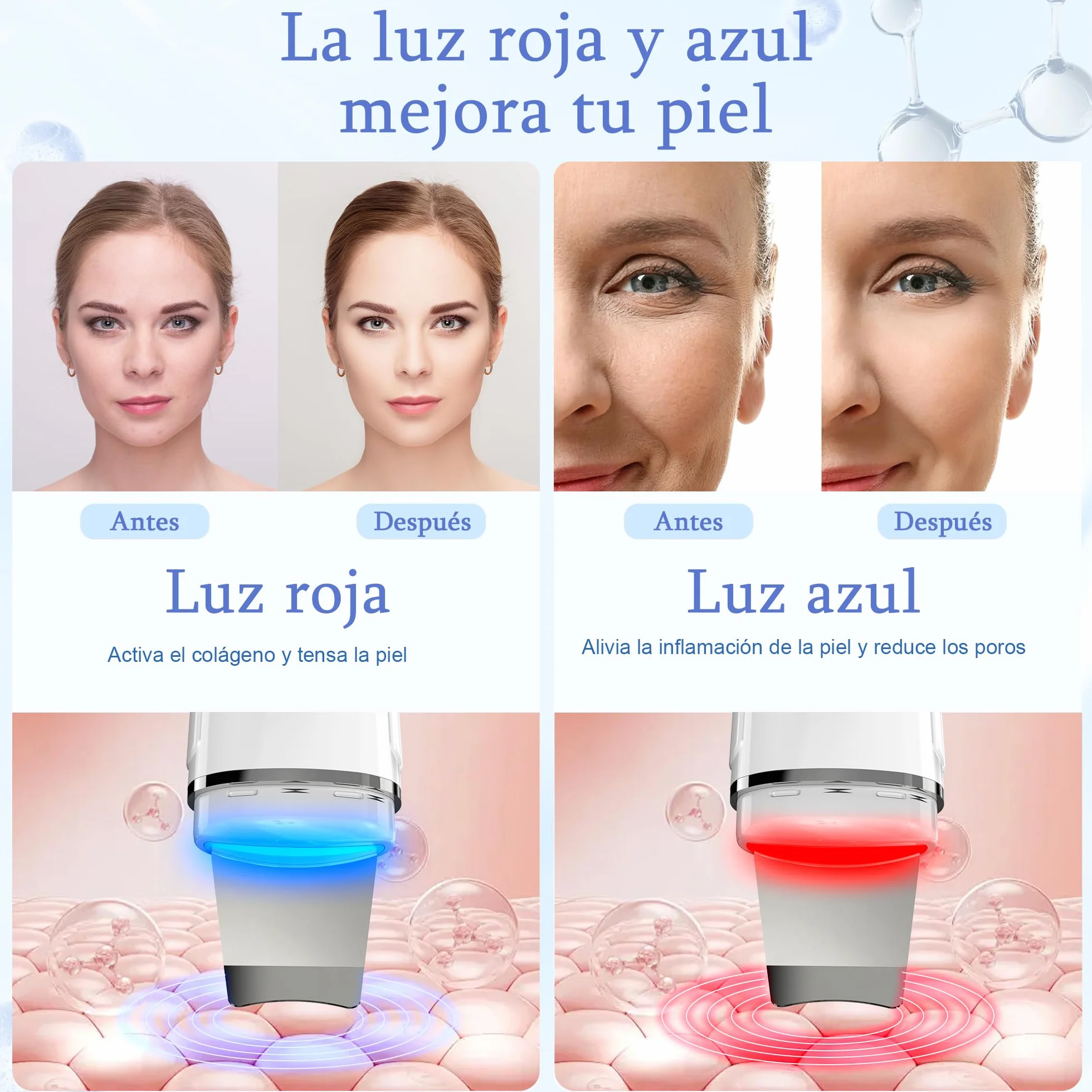 Peeling Ultrasónico Facial con 4 Modos y Luz Azul Roja, Limpiador de Ultrasonidos