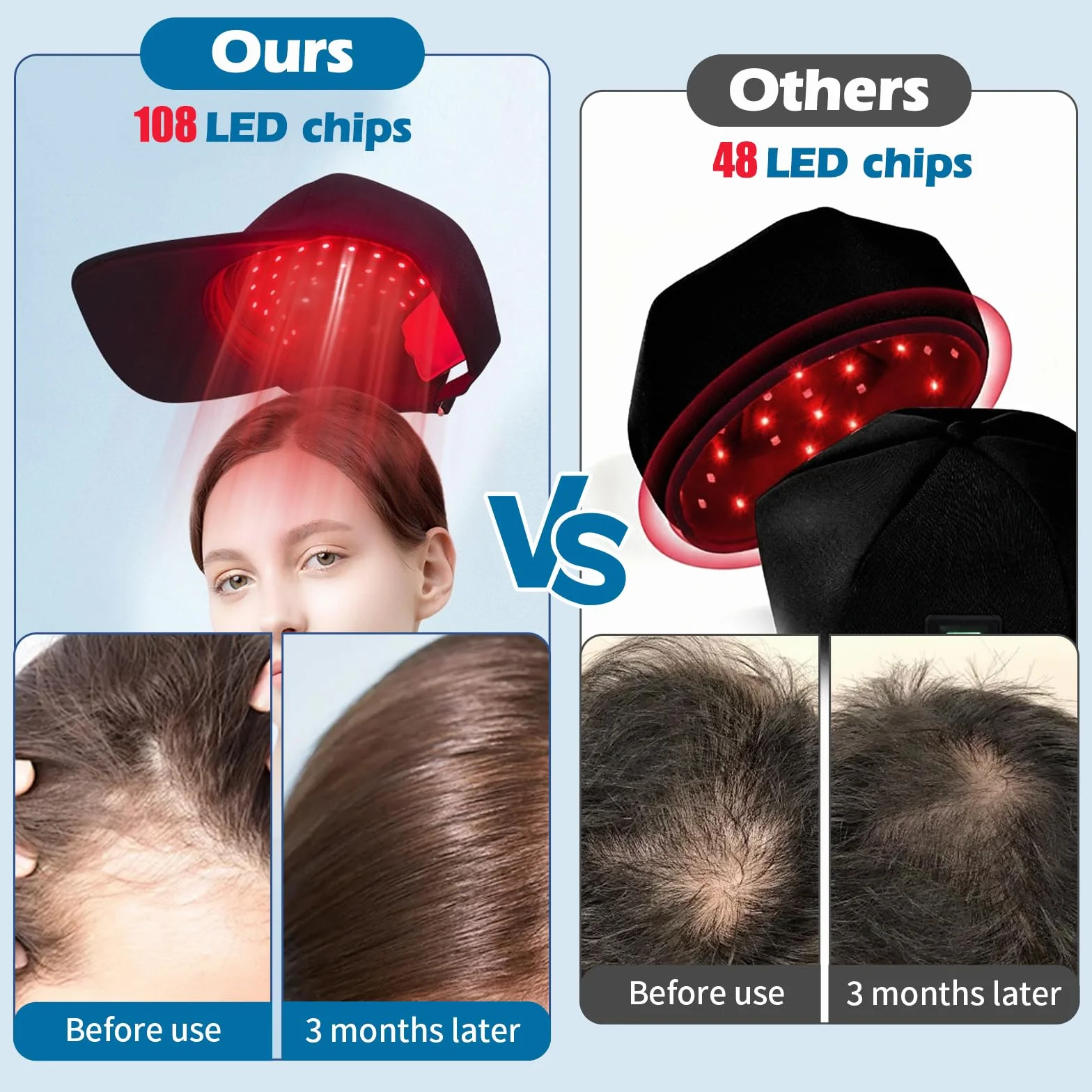 108 LED Red Light Cap Crecimiento Cabello 460/660/850nm Longitud Onda