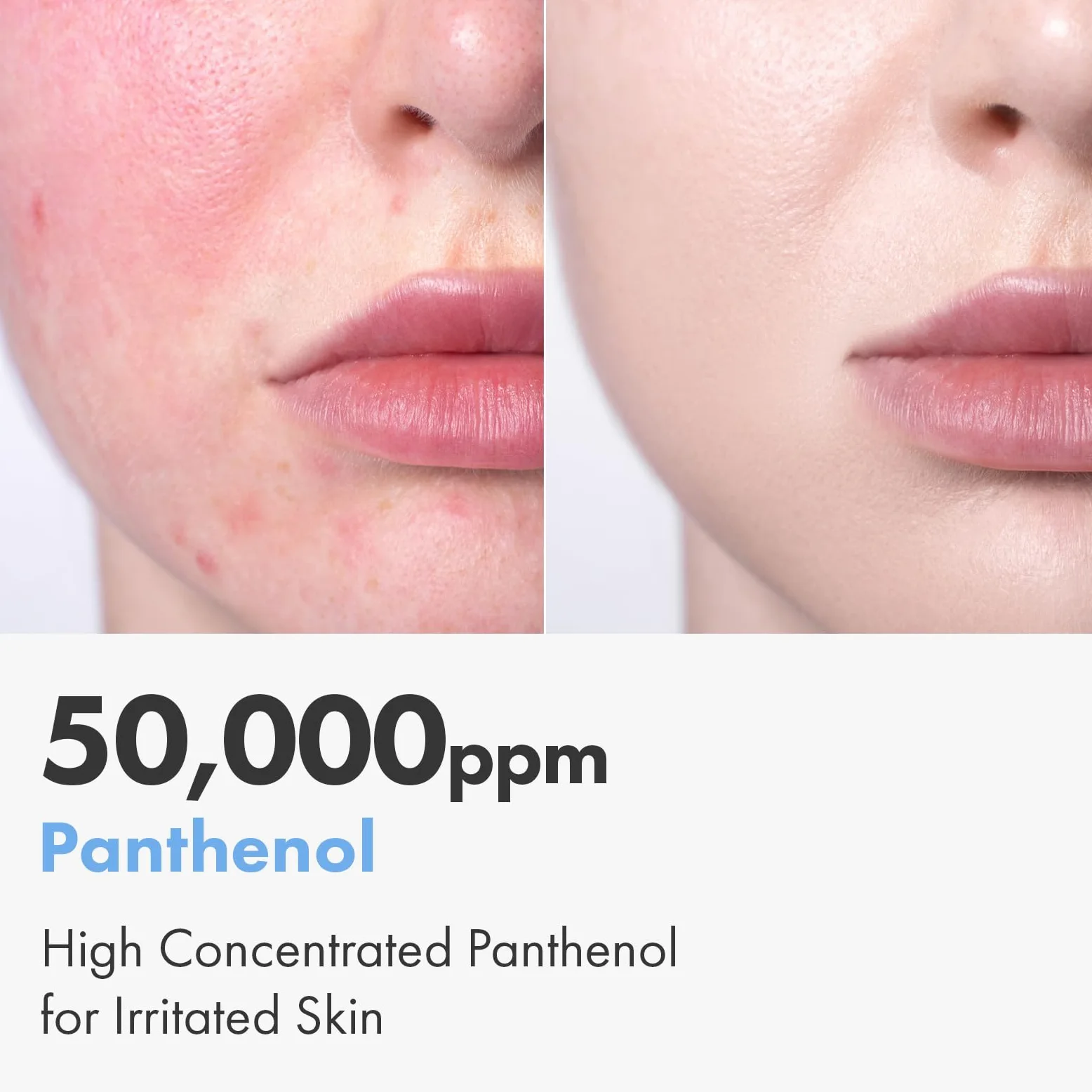 NATUREKIND Cica Panthenol Cream, 50,000 ppm Pantenol, Centella Asiática y Ácido Hialurónico, Hidratante Reparador Barrera para Piel Seca y Sensible, Cuidado de la Piel Coreano, 150 g