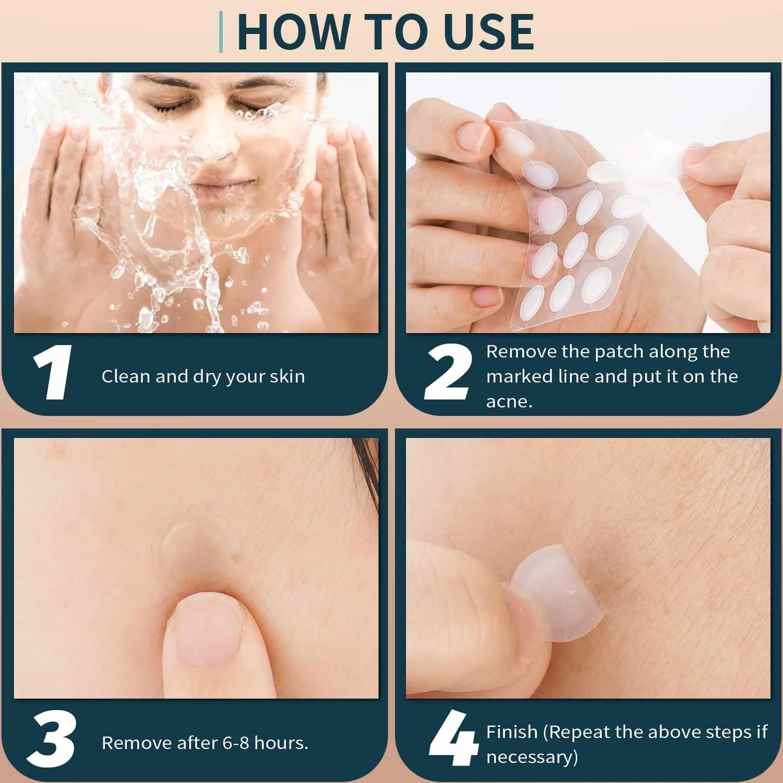 Parches Granos Hidrocoloides Invisibles 147 Piezas, Absorbentes Parches Acne Tratamiento 2 Tamaños 10/12mm