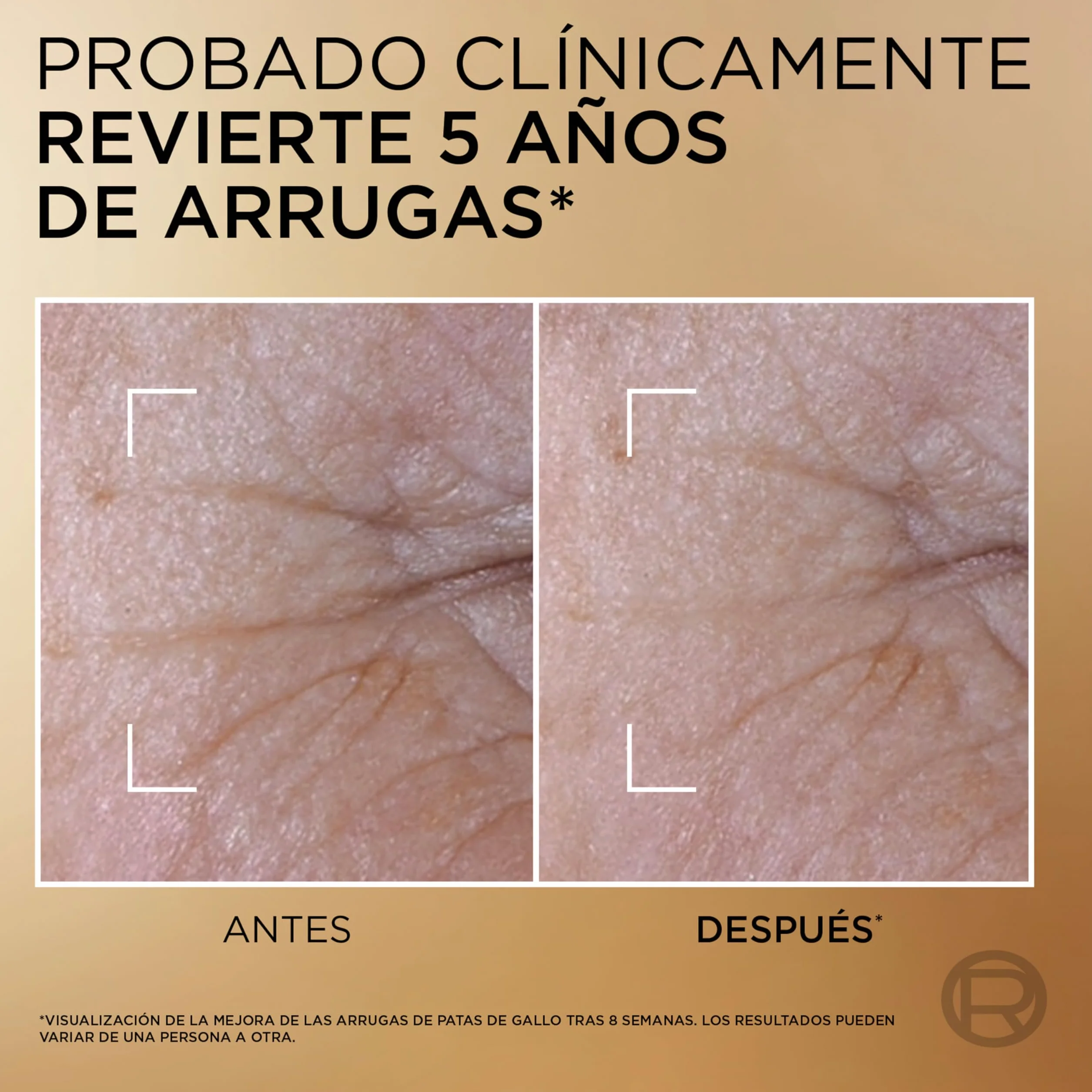L'Oréal Paris Age Perfect Sérum Le Duo Antiarrugas 30 ml