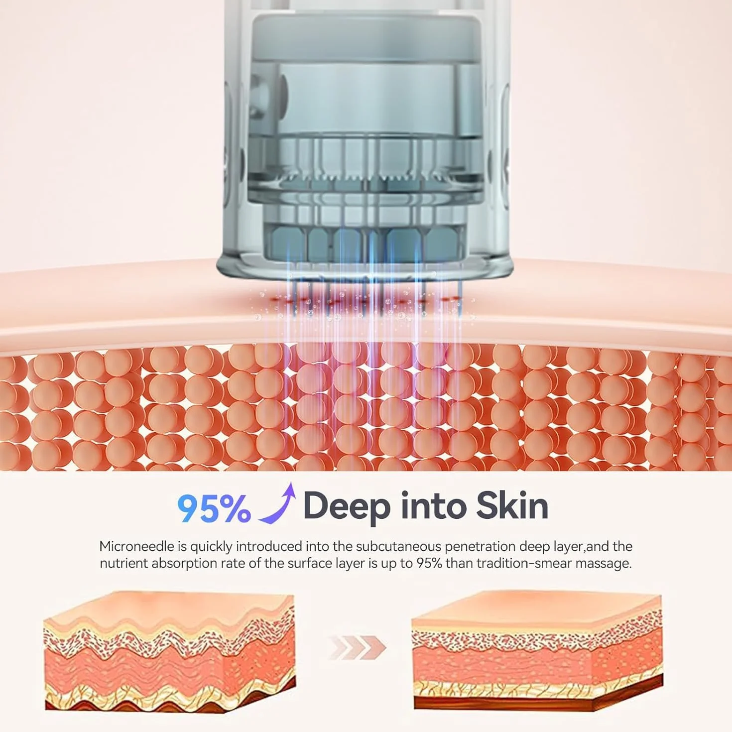 Dermapen Cartuchos de 16 Agujas 20pc, Repuesto para Microneedling M8