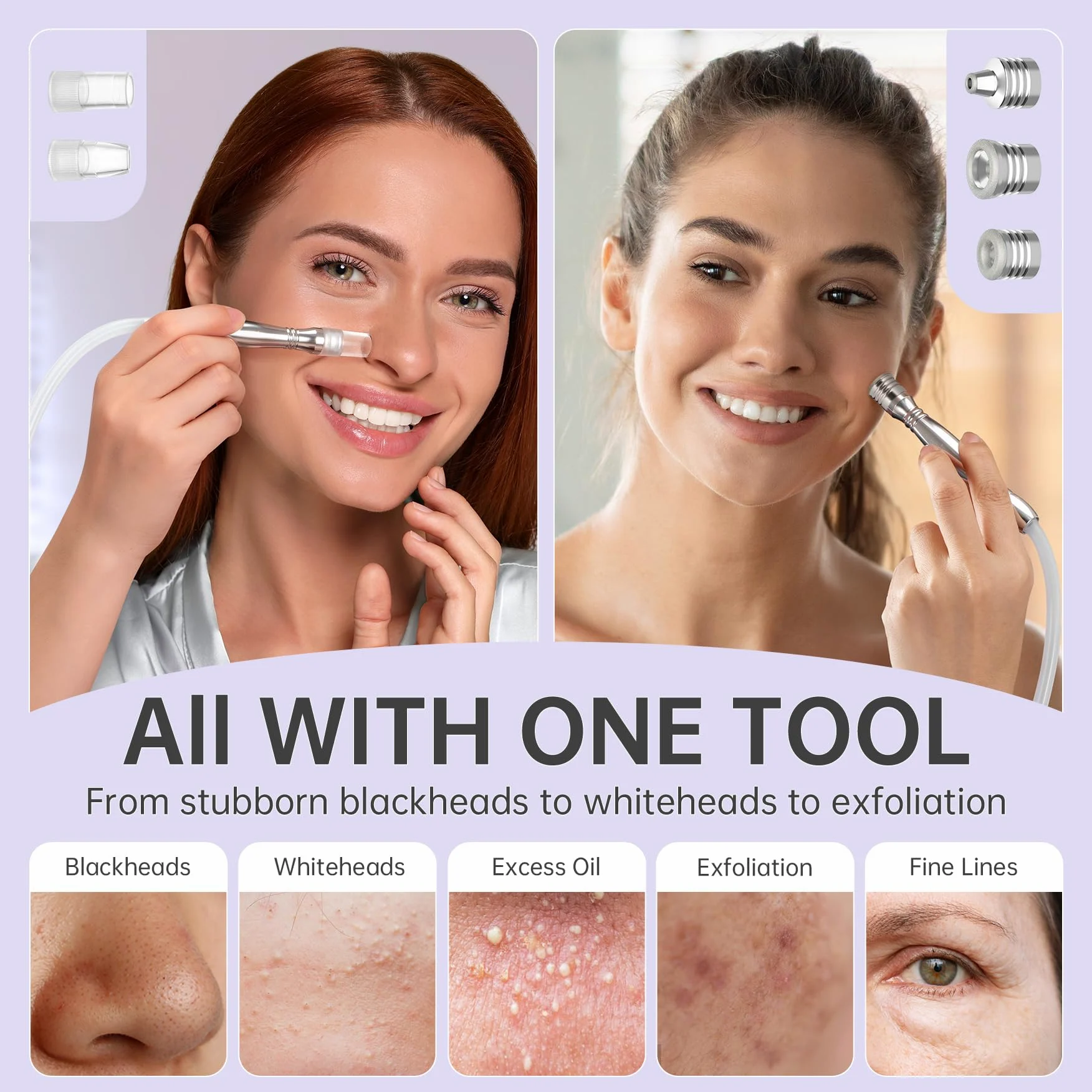 UNOISETION Removedores de puntos negros, 2 en 1 de grado profesional para spa en casa, limpiador facial de poros para puntos negros, puntos blancos, exfoliación, succión ajustable de 20-80 Kpa para