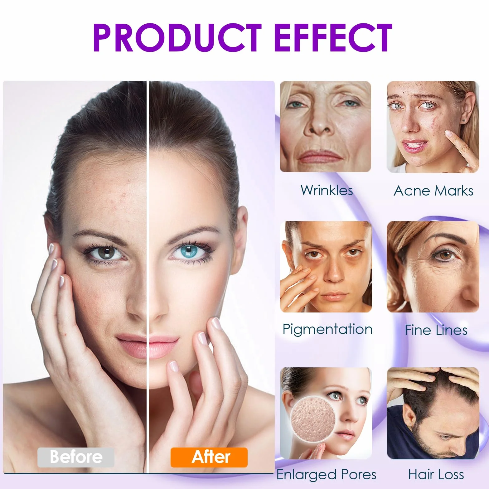 Dr. Pen Cartuchos Desechables 12 Pins para Microneedling, Compatibles con Modelo A10, 15 Pcs