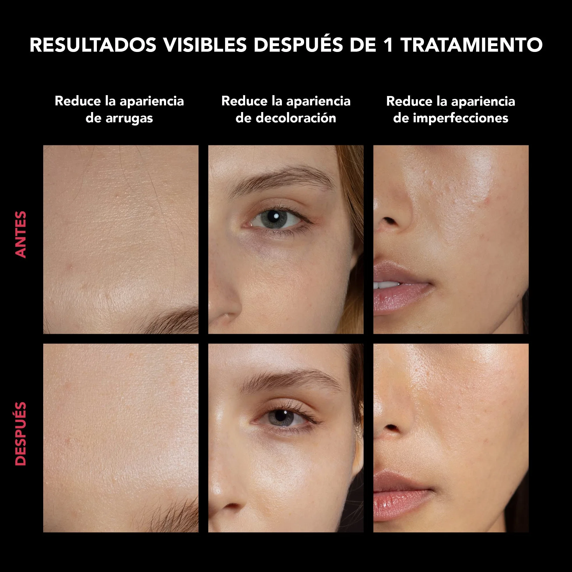 FAQ 202 Máscara facial LED inalámbrica con estuche de viaje - Cuidado antiedad con 8 ajustes - 600 puntos de luz para el tratamiento dirigido y el cuidado facial - Pack de viaje, ligero y duradero