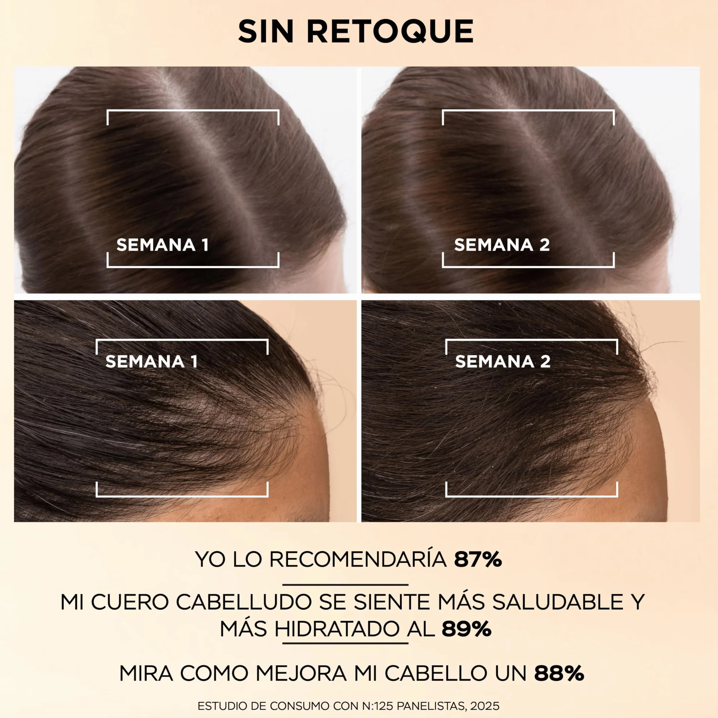 Pantene Grow Abundant Sérum Anticaída Cuero Cabelludo 60ml Tratamiento Cabello Mujer 3000mg Complejo Pro-Vitamina