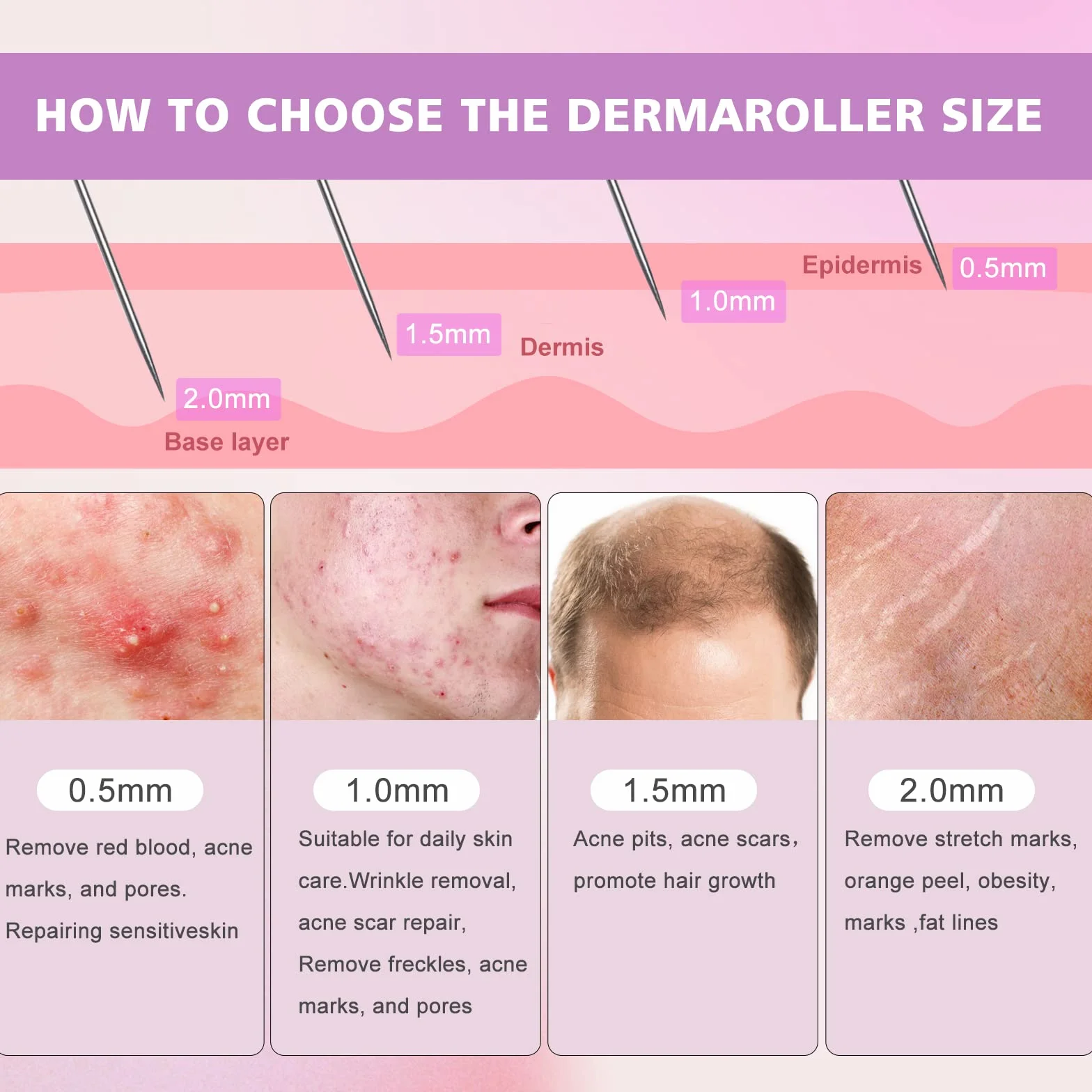 Derma Roller 0,5 mm 540 microagujas de titanio para cara barba cicatrices Rodillo facial