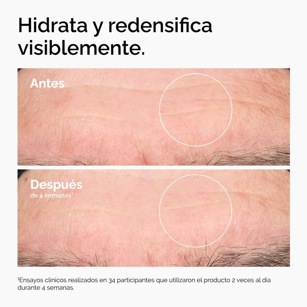 The Ordinary Hyaluronic Acid 2% + B5 Serum 30 ml