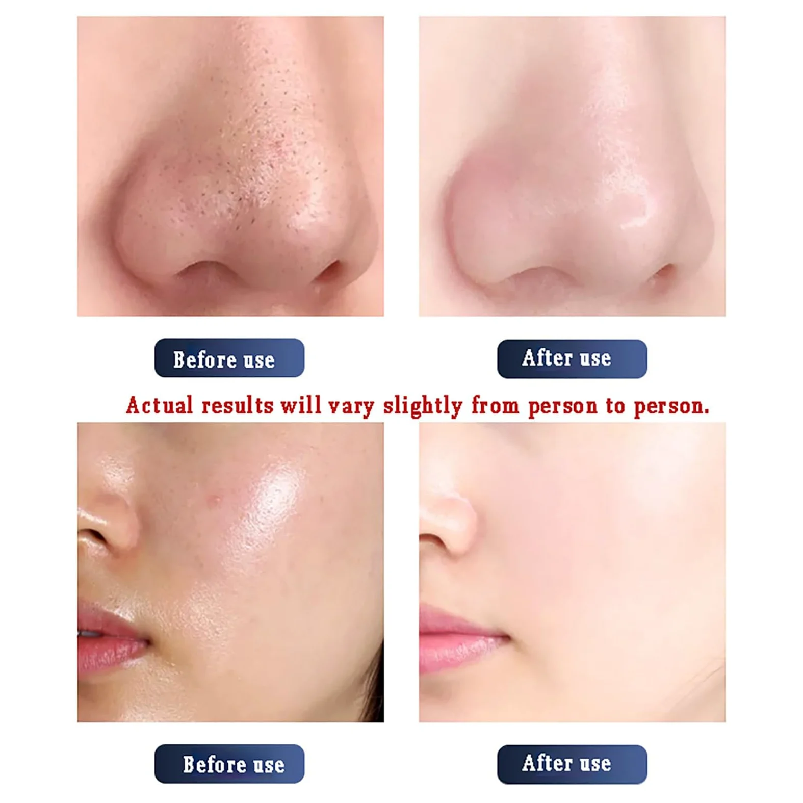 10 en 1 Máquina de Belleza con Hidrógeno, Equipo de Cuidado Facial, 10 Puntas Multifunción: Desde Limpieza Profunda hasta Reducción de Arrugas, Pantalla LED, Refuerzo de Barrera Cutánea