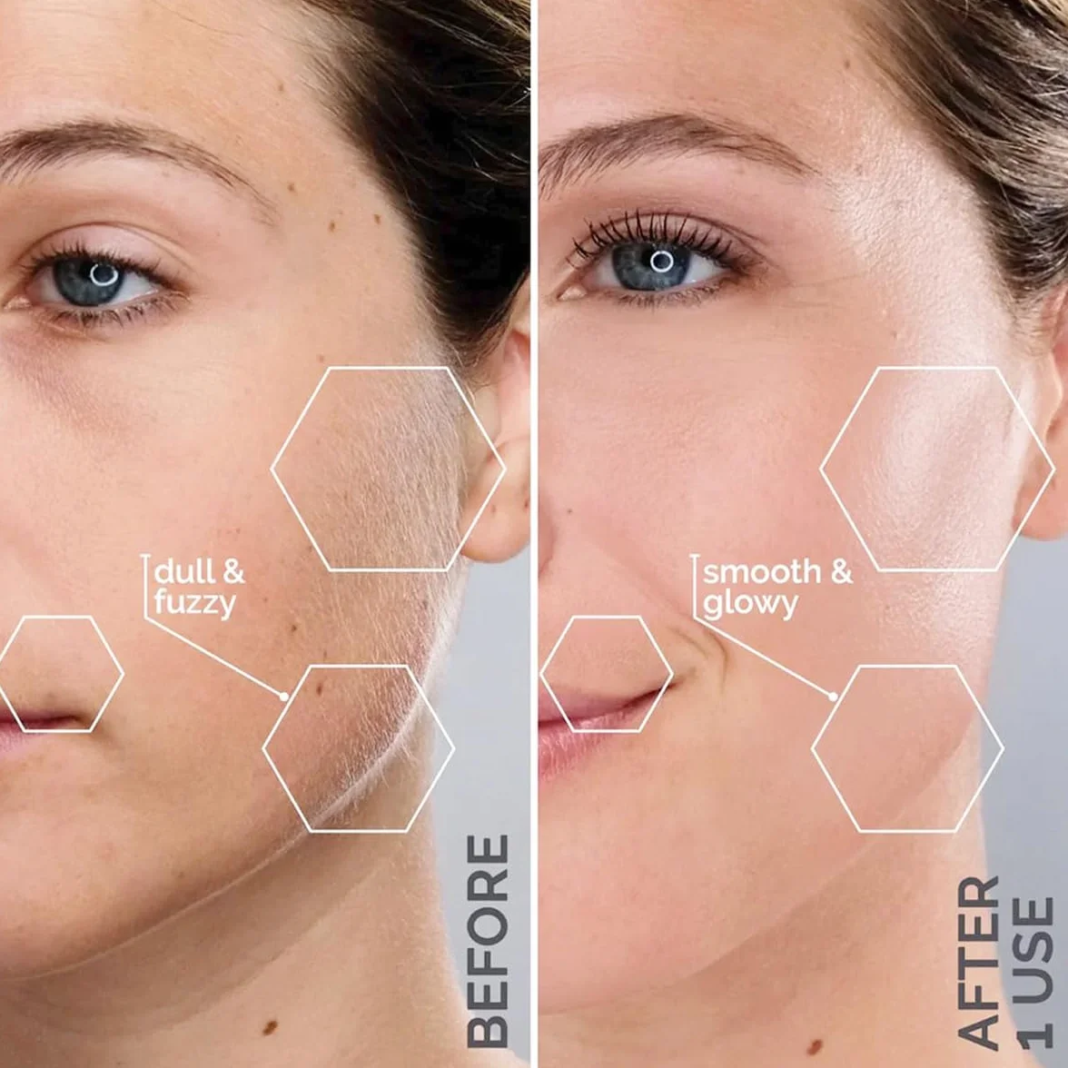 Michael Todd Beauty Sonicsmooth Pro+ Afeitadora Dermaplaning Facial LED 16 Cuchillas