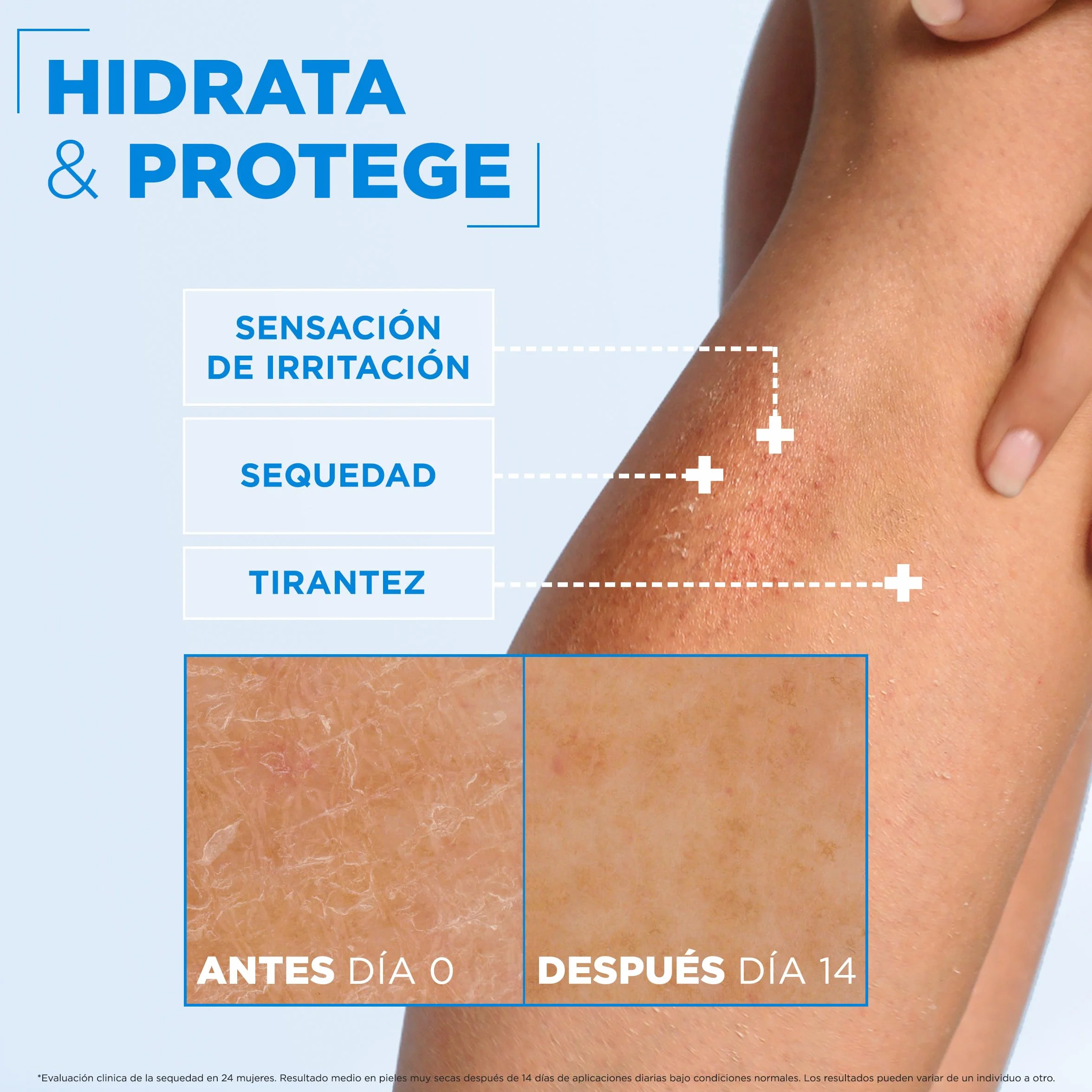 Mixa Crema Corporal Ceramide Protect 400 ml para Pieles Muy Secas con Glicerina, Escualeno y Ceramidas