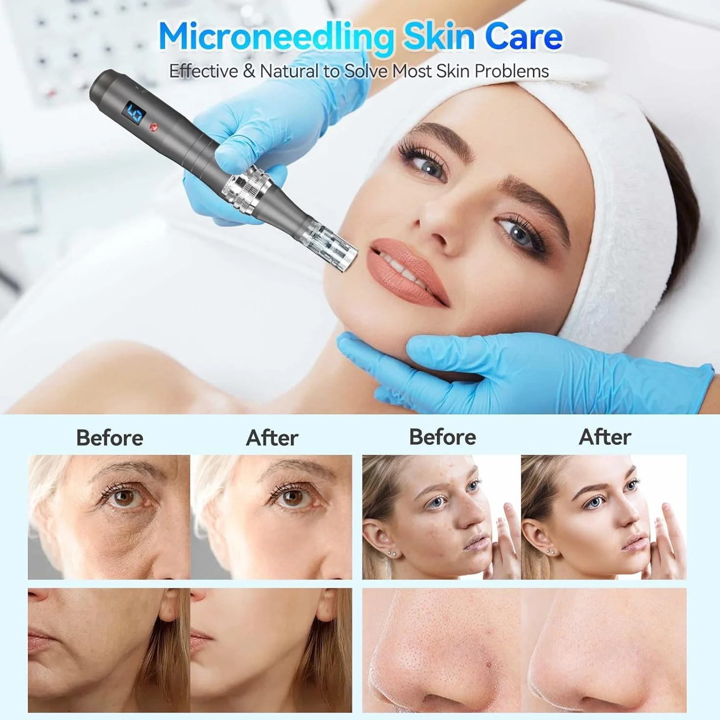 Dermapen Cartuchos de 16 Agujas 20pc, Repuesto para Microneedling M8