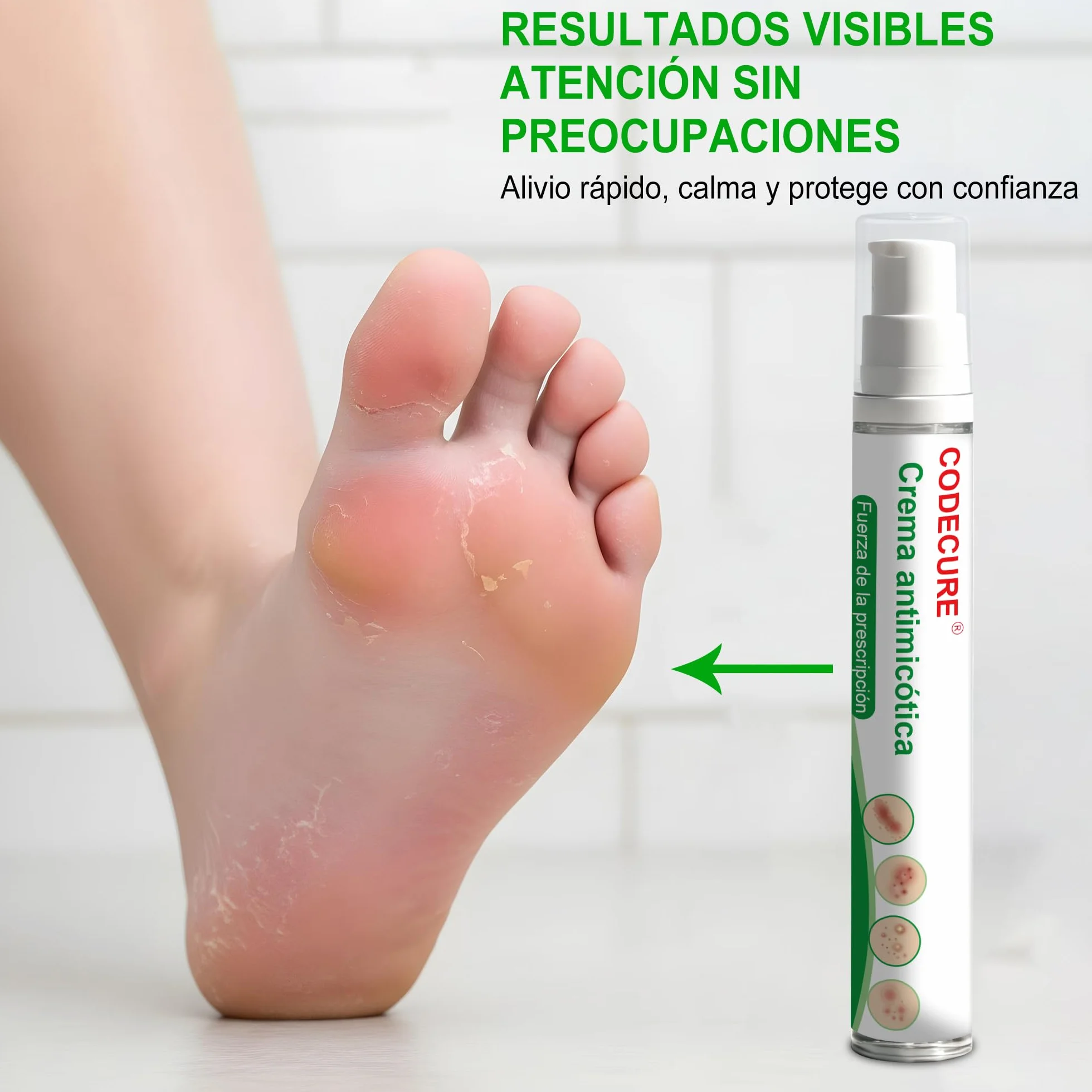 Crema antimicótica para pie de atleta, tiña inguinal y tiña - Fórmula suave - 18G 1-Pack