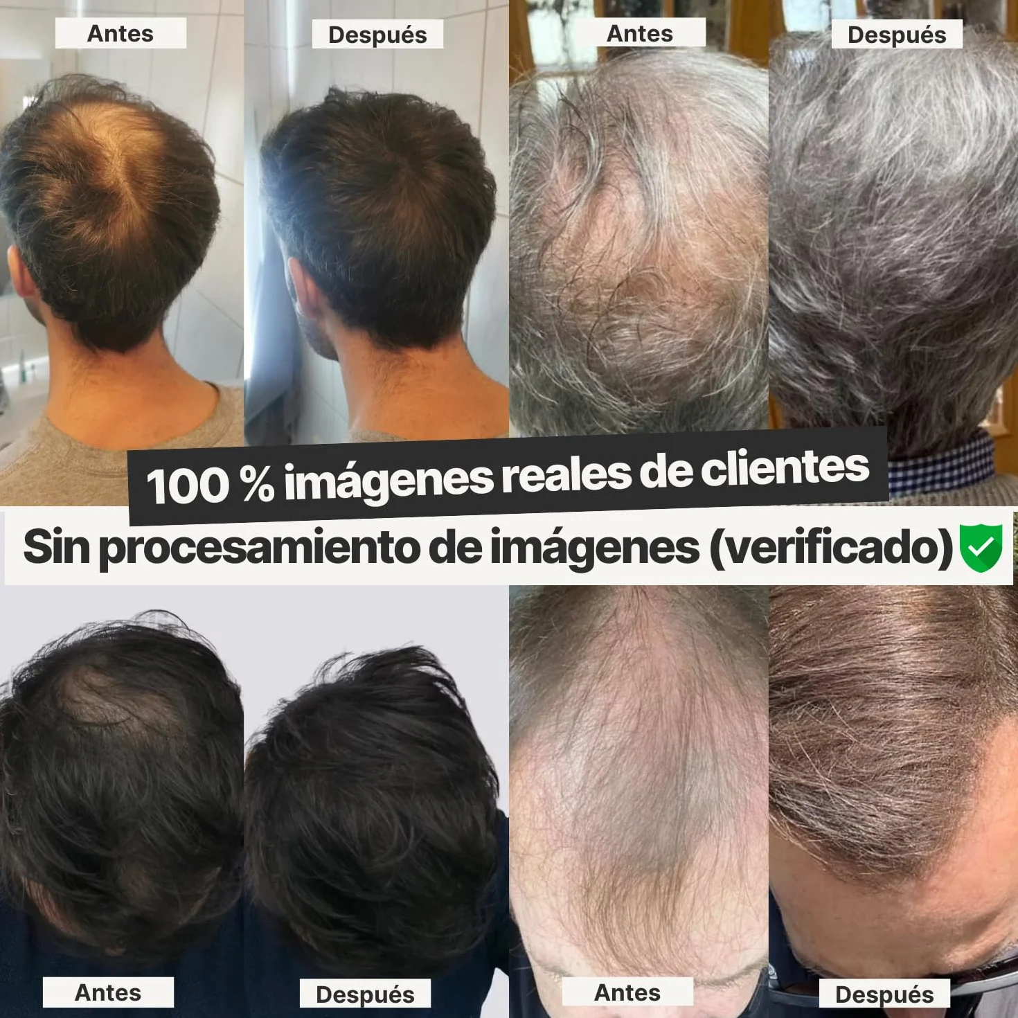 IMPERIO Microfibras Capilares Densificador Cabello 26g Castaño Oscuro