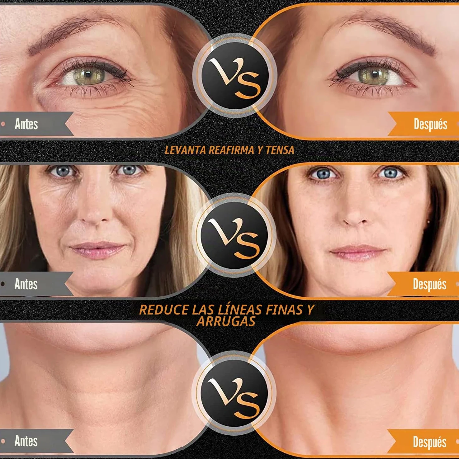 Elitzia Máquina facial de radiofrecuencia RF y EMS, uso doméstico, máquina de estiramiento de la piel, 3 tamaños, reemplazo de cabeza, levantamiento facial, reducción de arrugas, rejuvenecimiento de