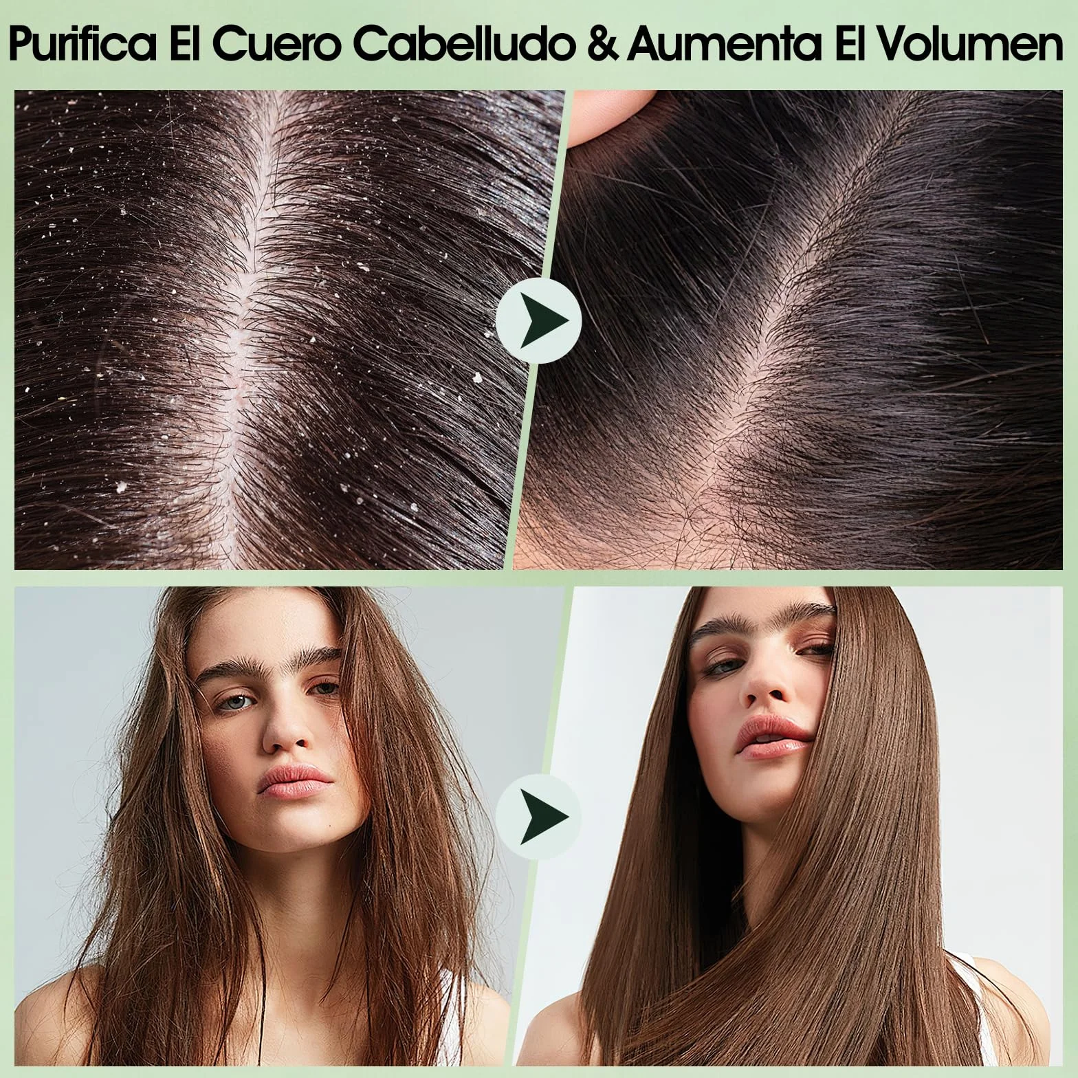 Exfoliante para cuero cabelludo 2 en 1 con aceite de menta, masajeador de silicona, 10,6 oz/300 g