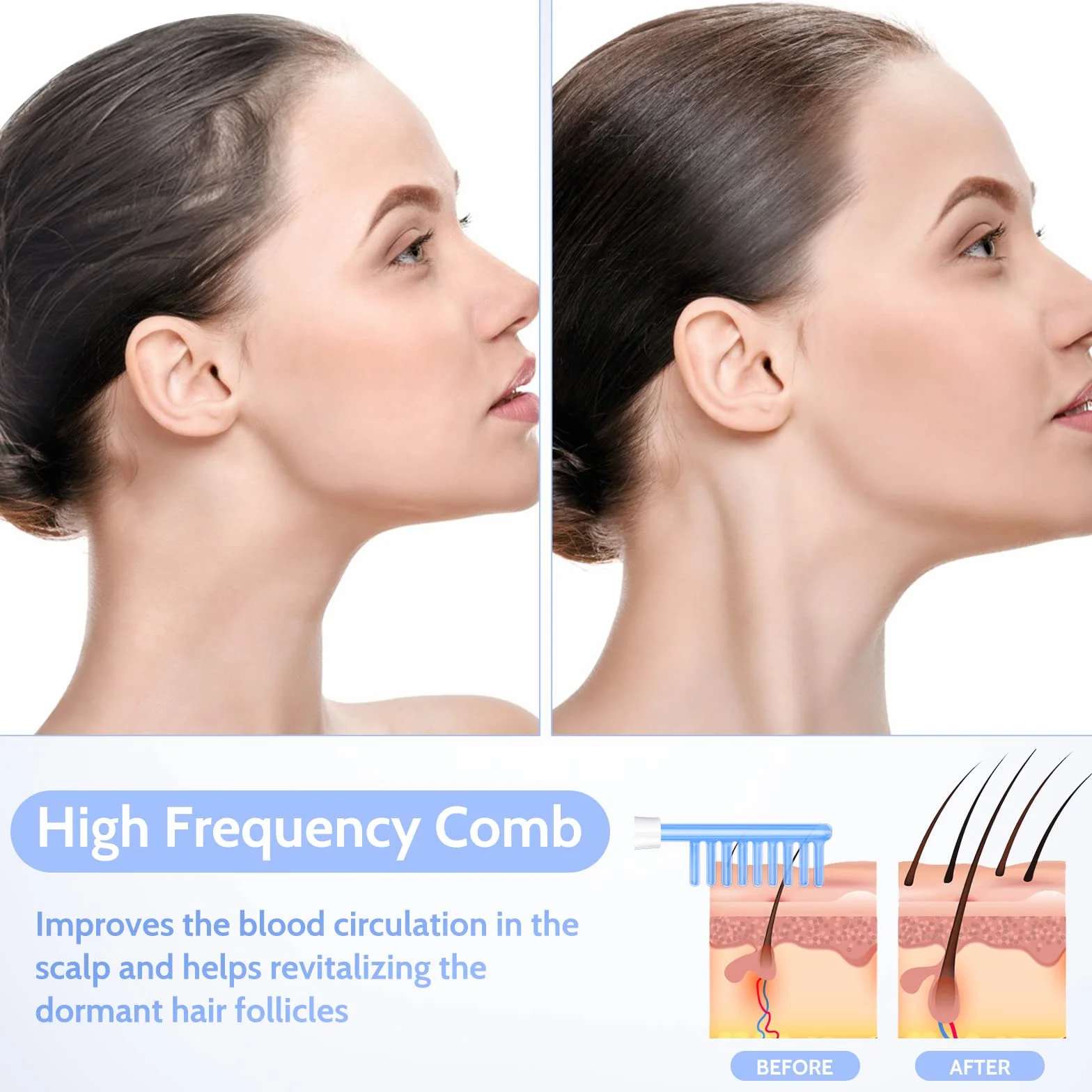 Yofuly Máquina de Alta Frecuencia Estetica Facial con 4 Azul Dispositivos de Masaje Facial Portátil