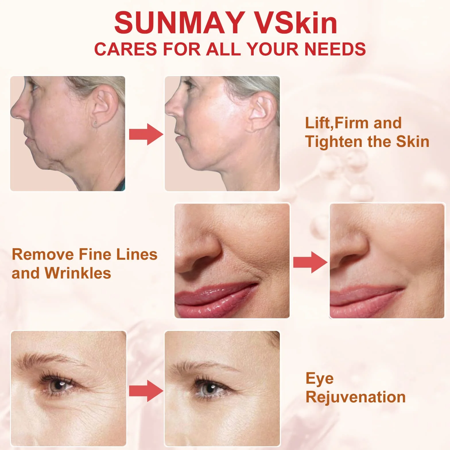 SUNMAY VSkin Aparato Radiofrecuencia Facial Masajeador Microcorriente Antienvejecimiento Rejuvenecimiento