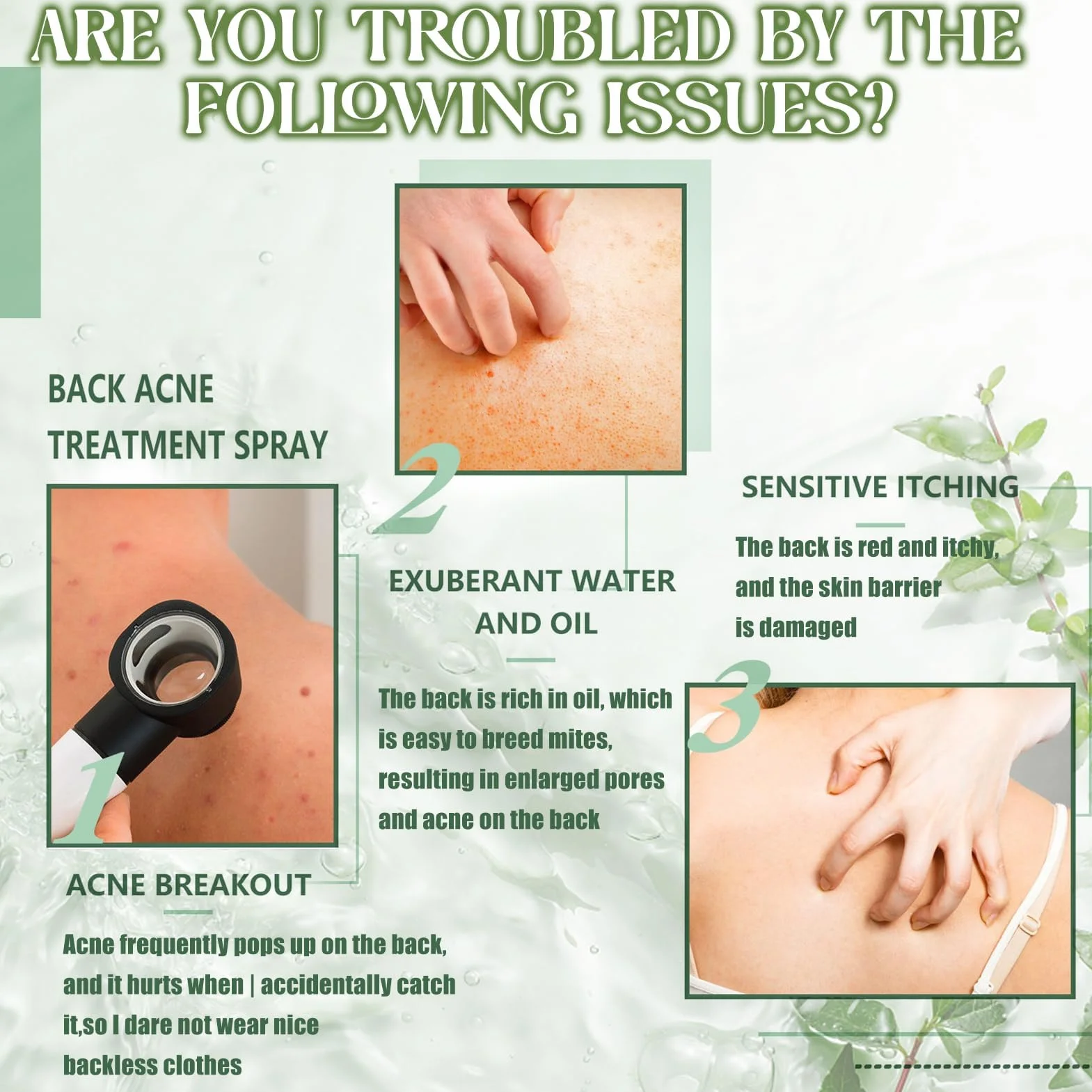 Spray De Tratamiento De Acné 2 PCS, Spray reparador del acné de espalda, Crema Acne Pecho y Espalda