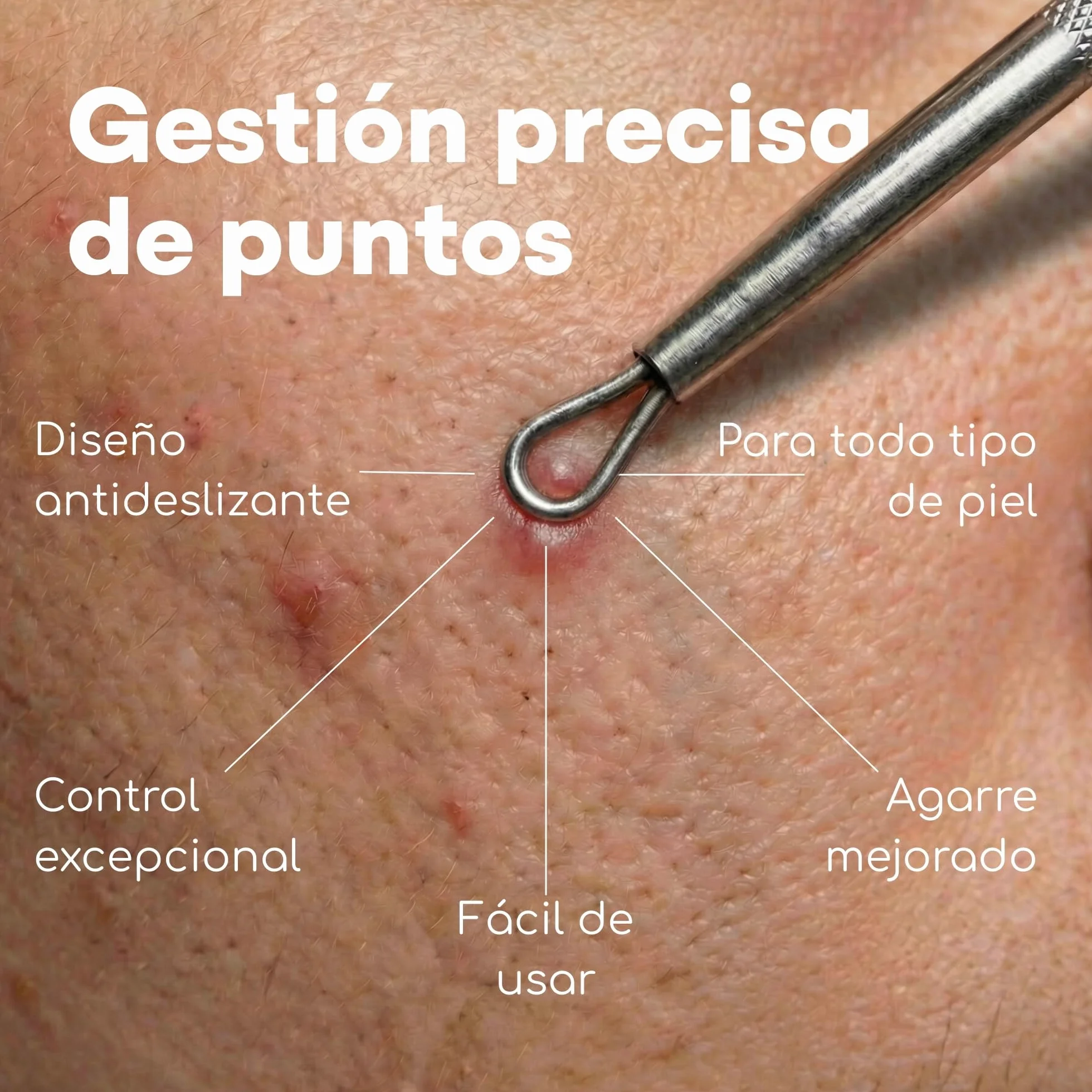 Kit removedor de espinillas y comedón, 7 piezas limpiador de poros