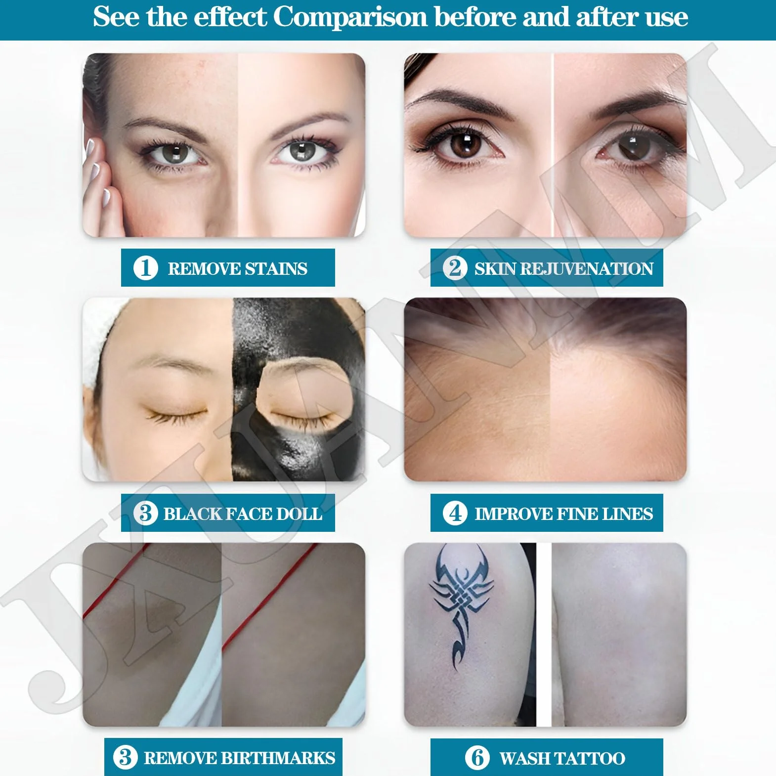 Máquina portátil de eliminación de Tatuajes con láser Pico Nd Yag con mira de Punto Rojo para rejuvenecimiento en Salones de Belleza. 6Probes