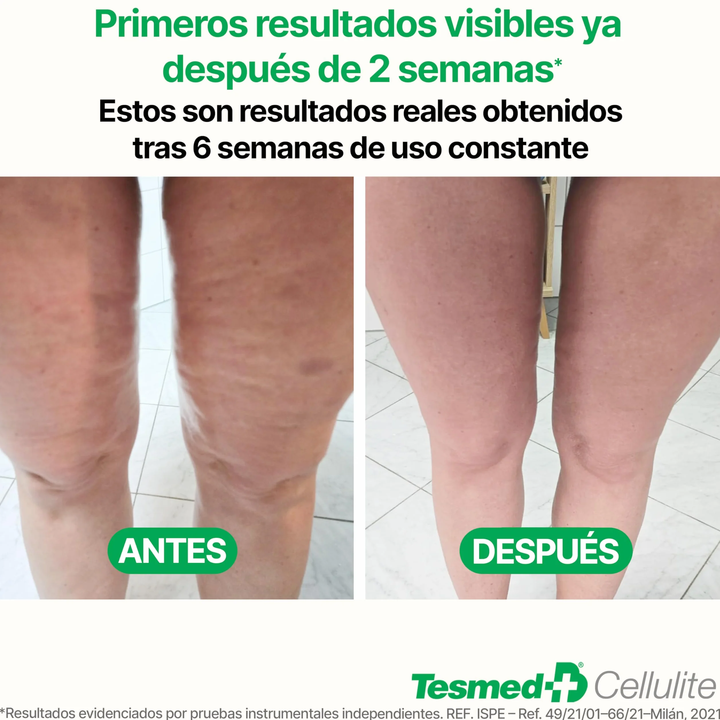 TESMED Masajeador Anticelulítico Reductor Rodillo Anticelulítico Reafirmante Patentado Fabricado en Italia