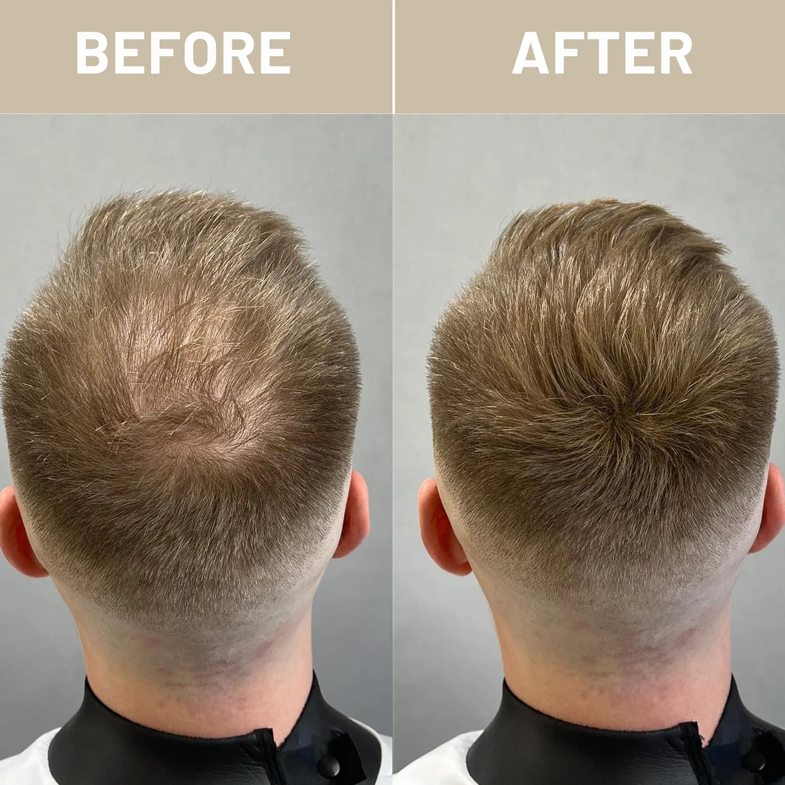 Fibras Capilares 28g Cobertura Instantánea Cabello Fino Volumen Natural Larga Duración Castaño Oscuro