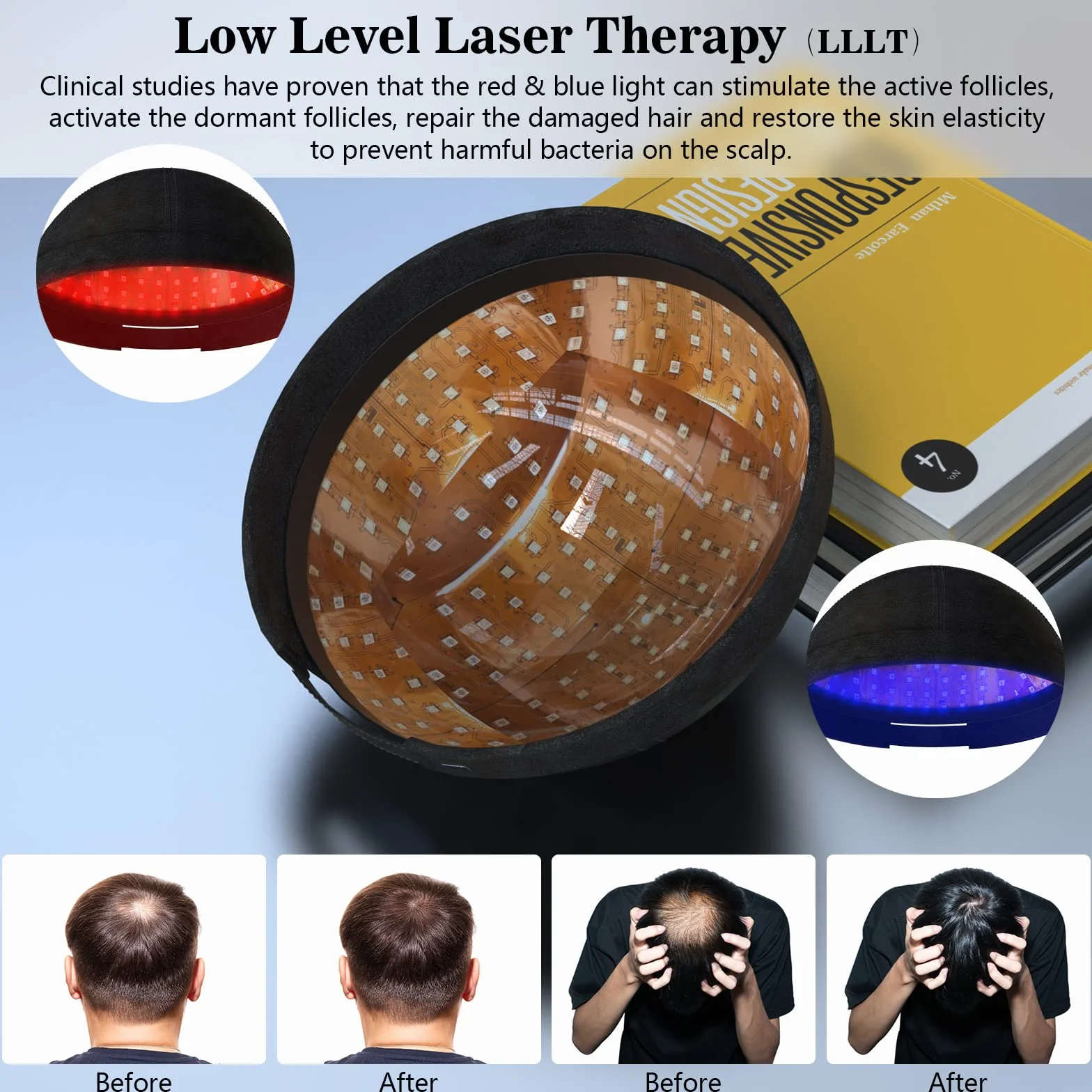 KTS Casco láser para crecimiento del cabello, tratamiento de pérdida de cabello para hombres y mujeres