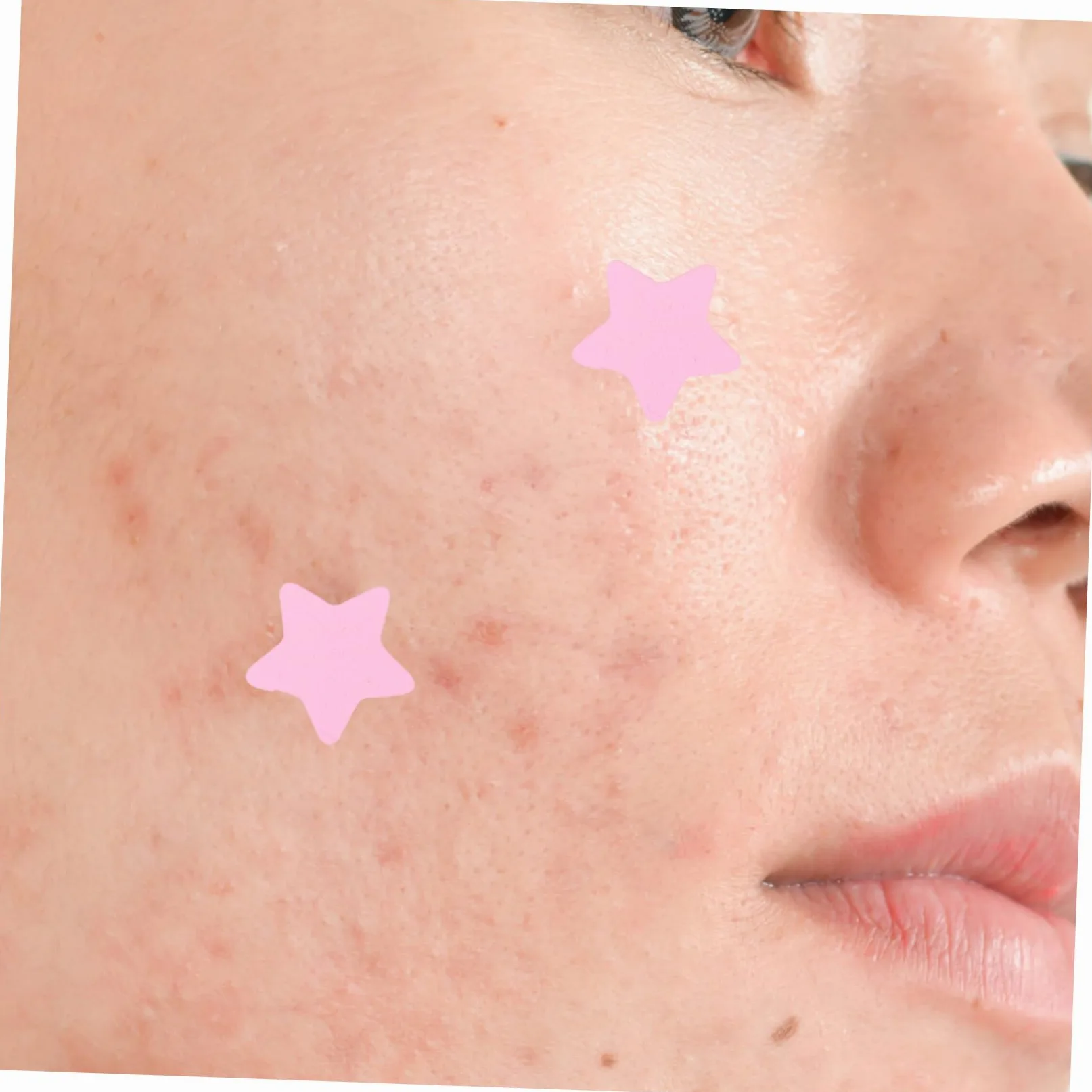 Parches Para Acné Hidrocoloides Coloridos Para Espinillas De Parches Invisibles Para Cuidado Facial Material Y Efecto Hidratante 4 Hojas X 5