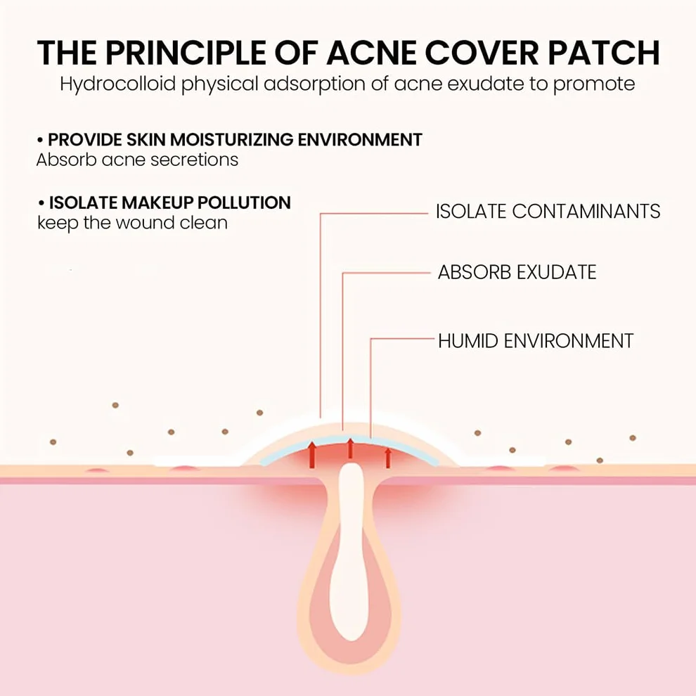Star Pimple Patches, Hydrocolloid Spot Patches with Tea Tree Oil, 2 Sizes, 5 Colors, 200 Dots, Face Body Blemish Cover (1 Box)