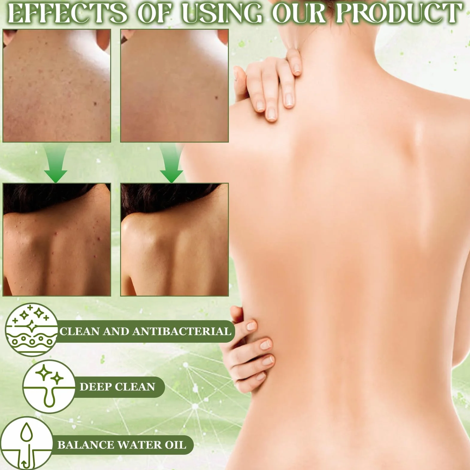 Spray De Tratamiento De Acné 2 PCS, Spray reparador del acné de espalda, Crema Acne Pecho y Espalda