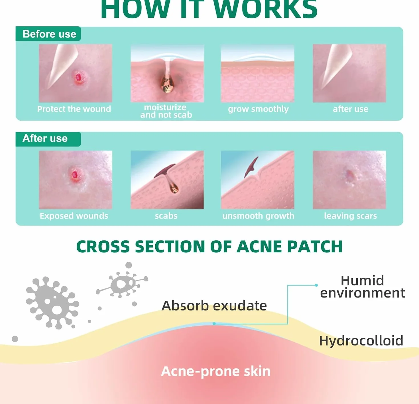 ACOTYE Parches antiespinillas hidrocoloide 210 unidades ácido salicílico niacinamida aceite de árbol de té 4 tamaños 8-14 mm