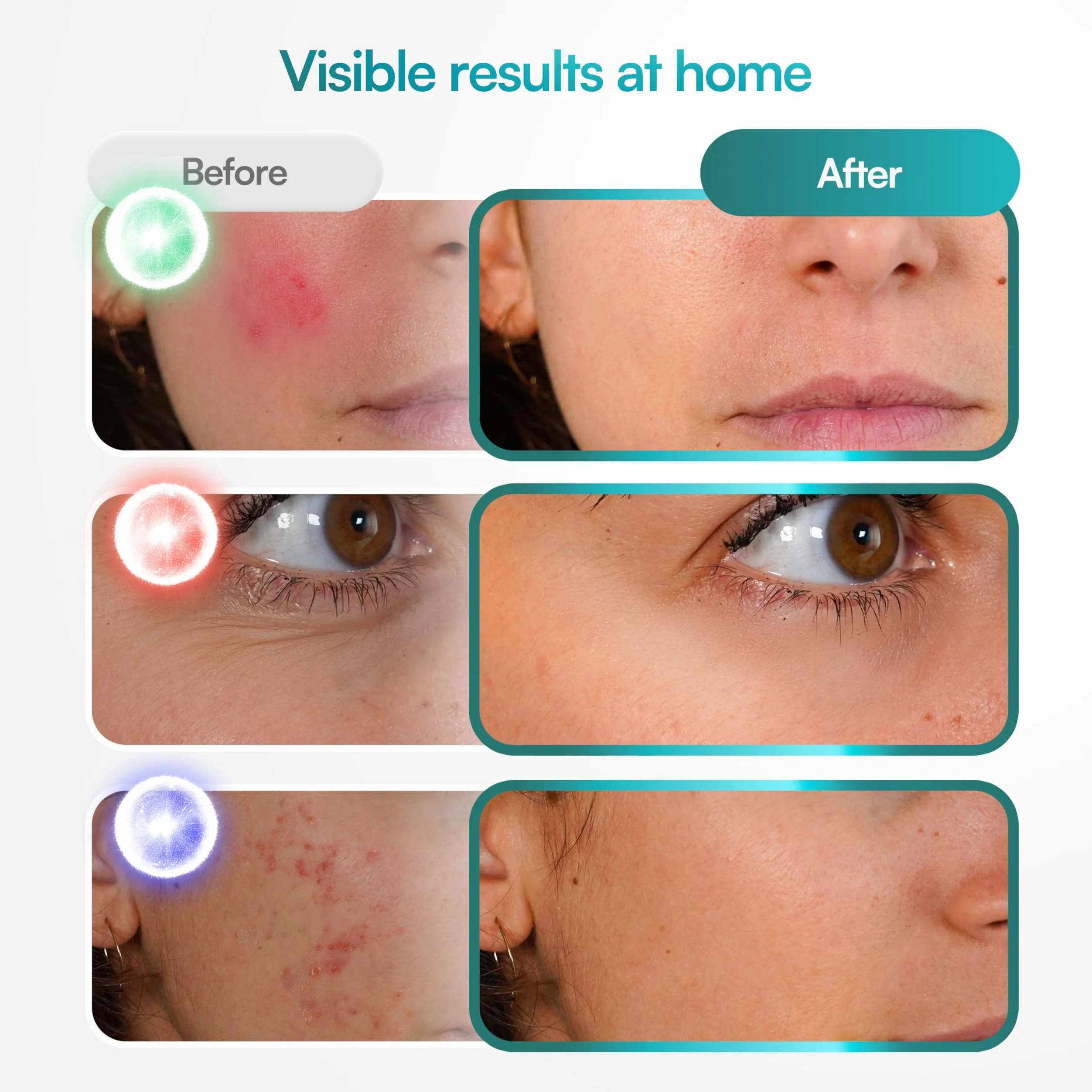 Mascarilla LED fototerapia - máscara de terapia de luz roja inspirada en el cuidado de la piel coreano - 8 modos de color con luces azules, rojas y NIR - Diseño ligero 3D para