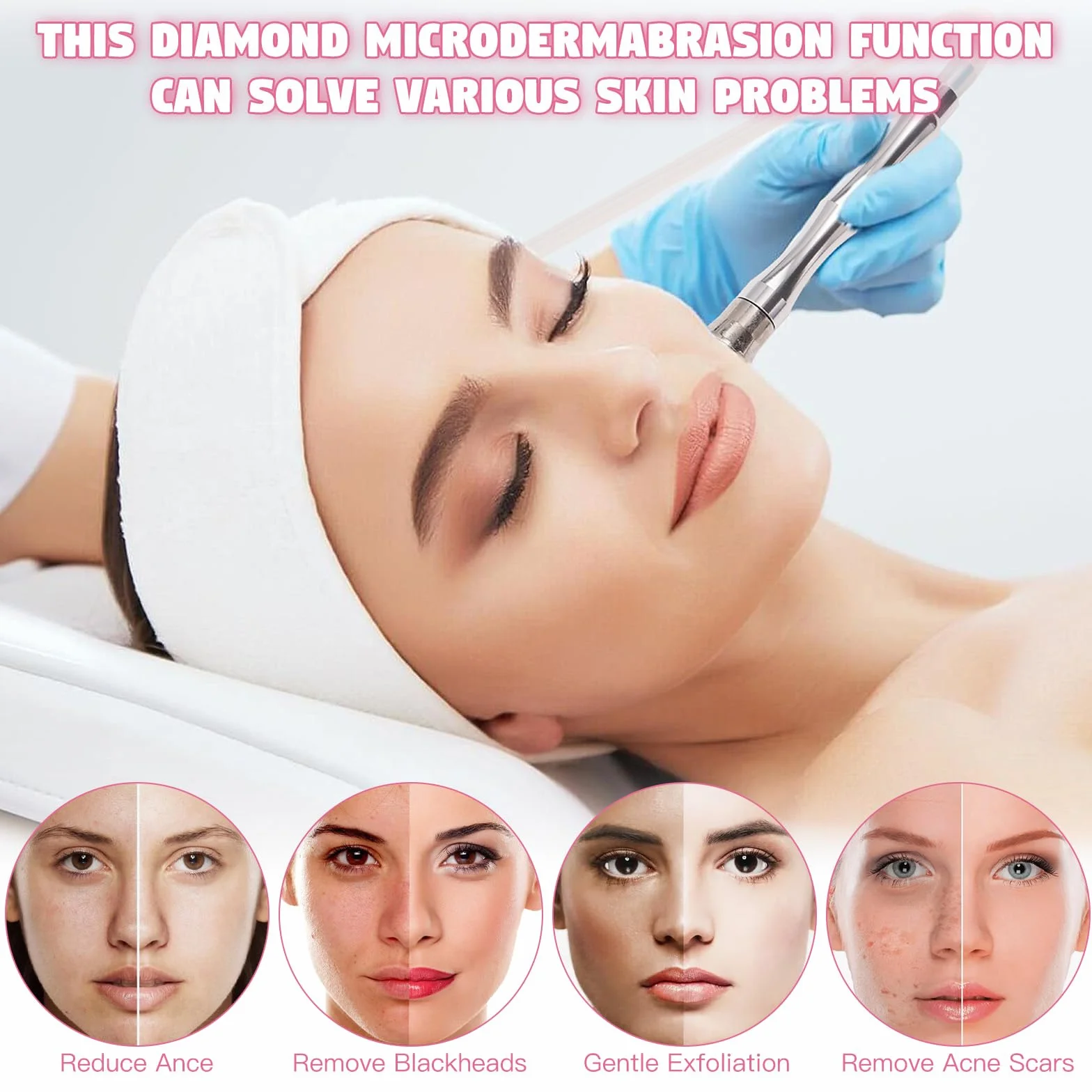 Beauty Star - Máquina de microdermoabrasión, profesional de 65 a 68 cmhg, potencia de succión al vacío, máquina de limpieza facial, equipo de belleza para el cuidado de la piel con aspiradora y spray