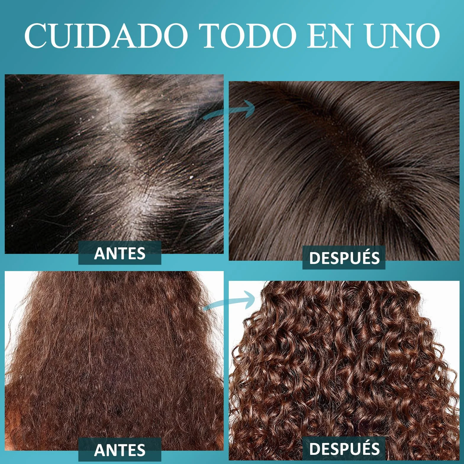 Exfoliante para el Cuero Cabelludo con Biotina y Ácido Salicílico para Crecimiento del Cabello, Cabello Graso y Caspa