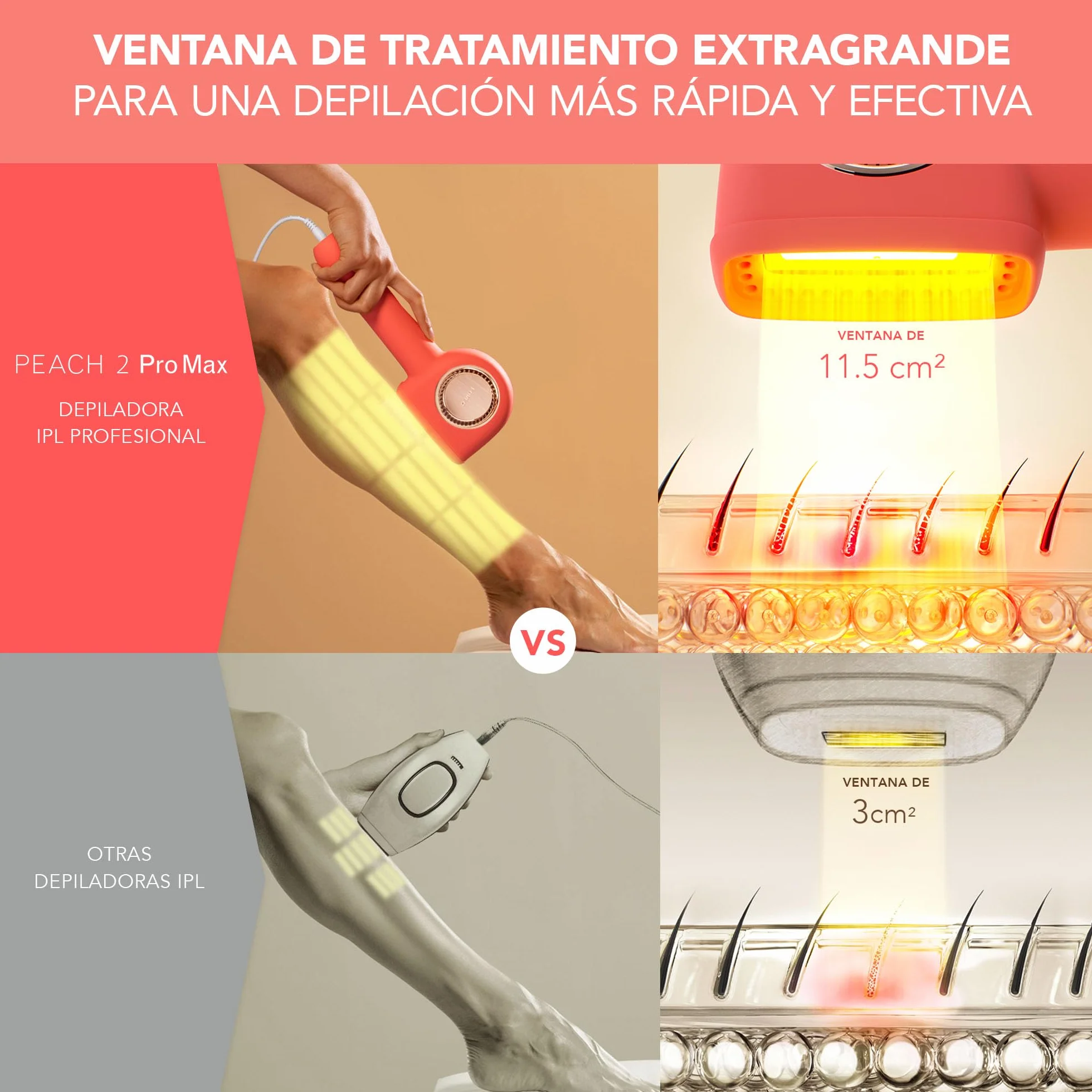 FOREO PEACH 2 Pro Max IPL depiladora laser facial y corporal para mujer y hombre